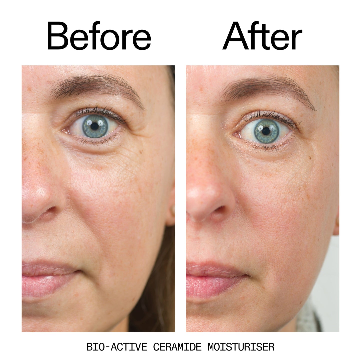 barrier-boosting-trio-l8 Bio-Active_Before_After_2000x2000_600947b4-e8c5-425a-9155-fc15bc83aa12.jpg