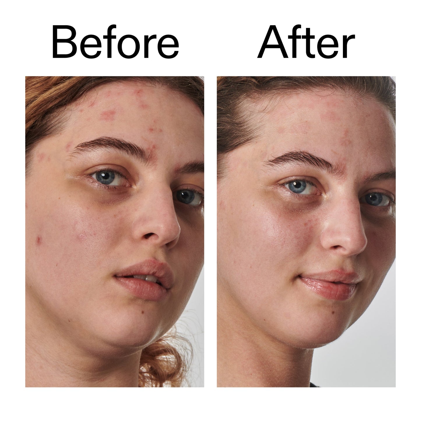 10-urea-moisturizer-y2 Dry_and_Rough_Skin_Solution_Before_After_2000x2000_efa6e639-5c39-49bd-a5dd-f0220293120a.jpg