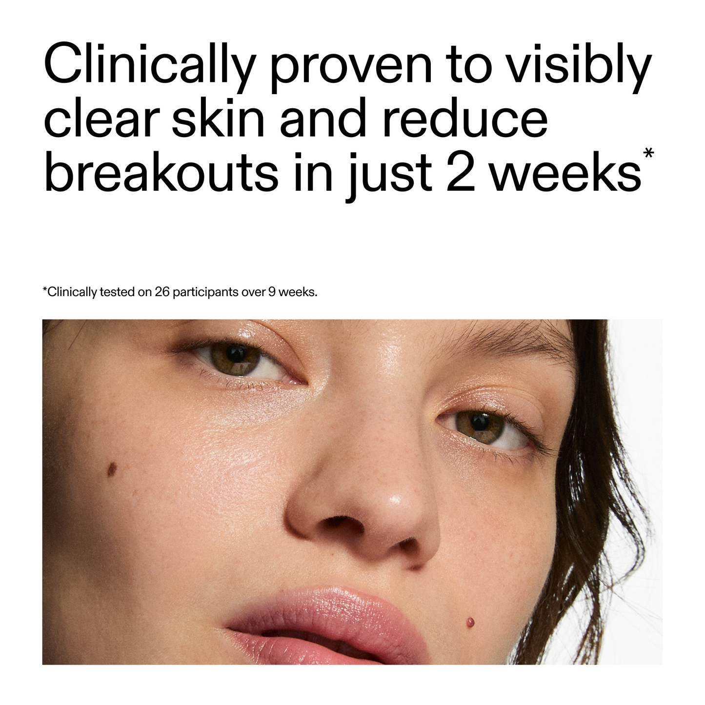 360-acne-clearing-duo-h7 360_Serum_Key_Claim.png