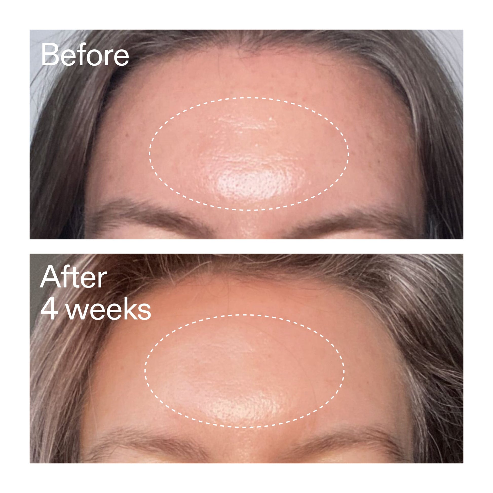 advanced-0-2-retinal-serum-z9 AdvancedRetinal_BeforeAfter1_2000x2000_1da6bb0a-29dd-41d1-95b7-8679696bbf0f.jpg