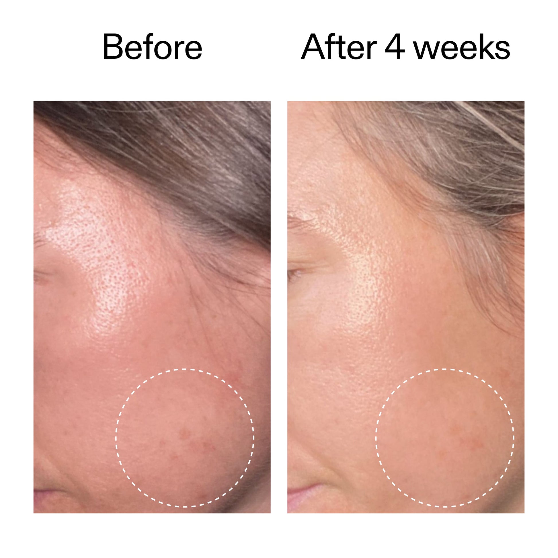 advanced-0-2-retinal-serum-z9 AdvancedRetinal_BeforeAfter2__2000x2000_62fb16bb-77ae-4d63-8500-88dbf847f4b9.jpg