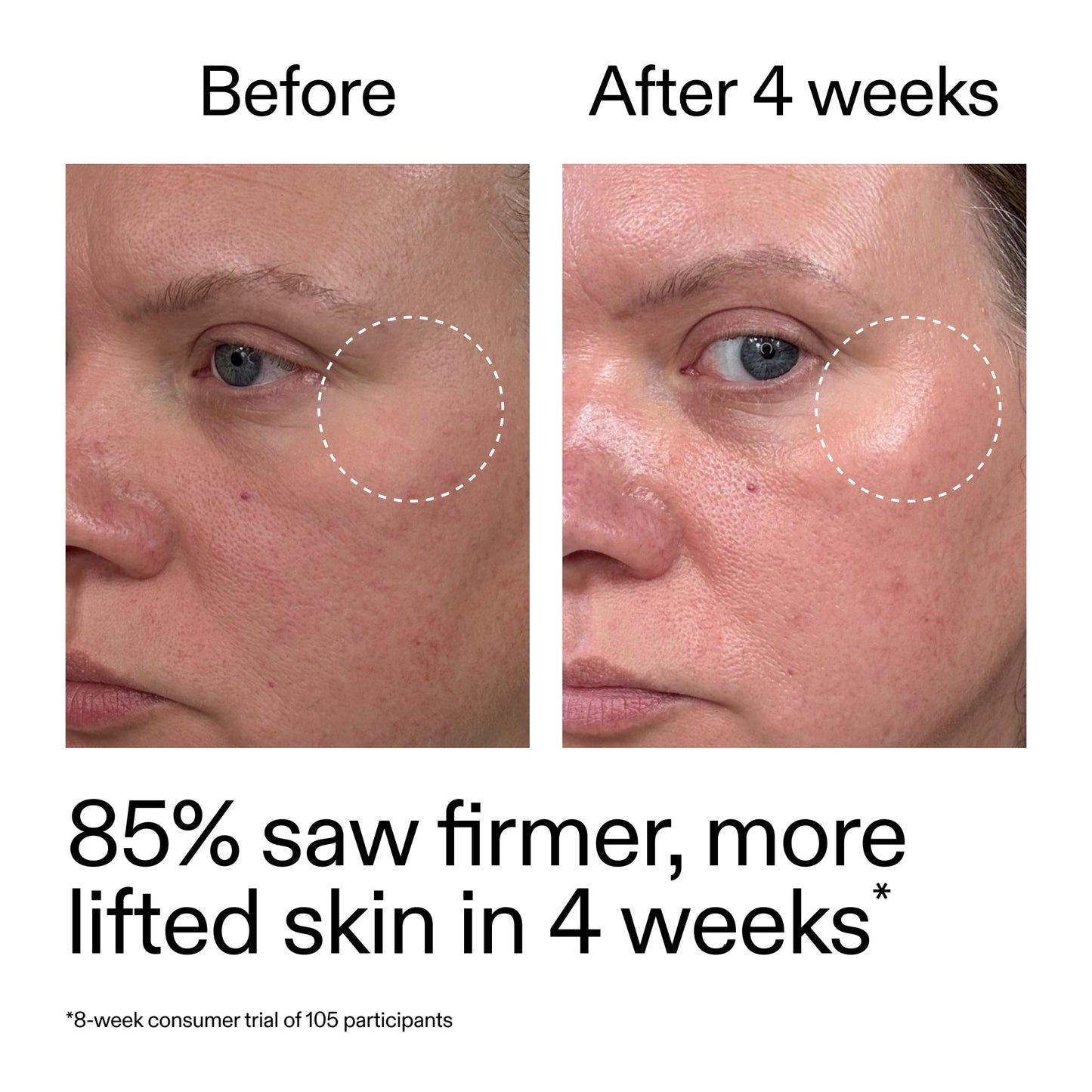 advanced-0-2-retinal-serum-duo-w4 AdvancedRetinal_BeforeAfter_Claim1_2000x2000_3a315aa8-f408-4b33-bbeb-0d9209f98404.jpg