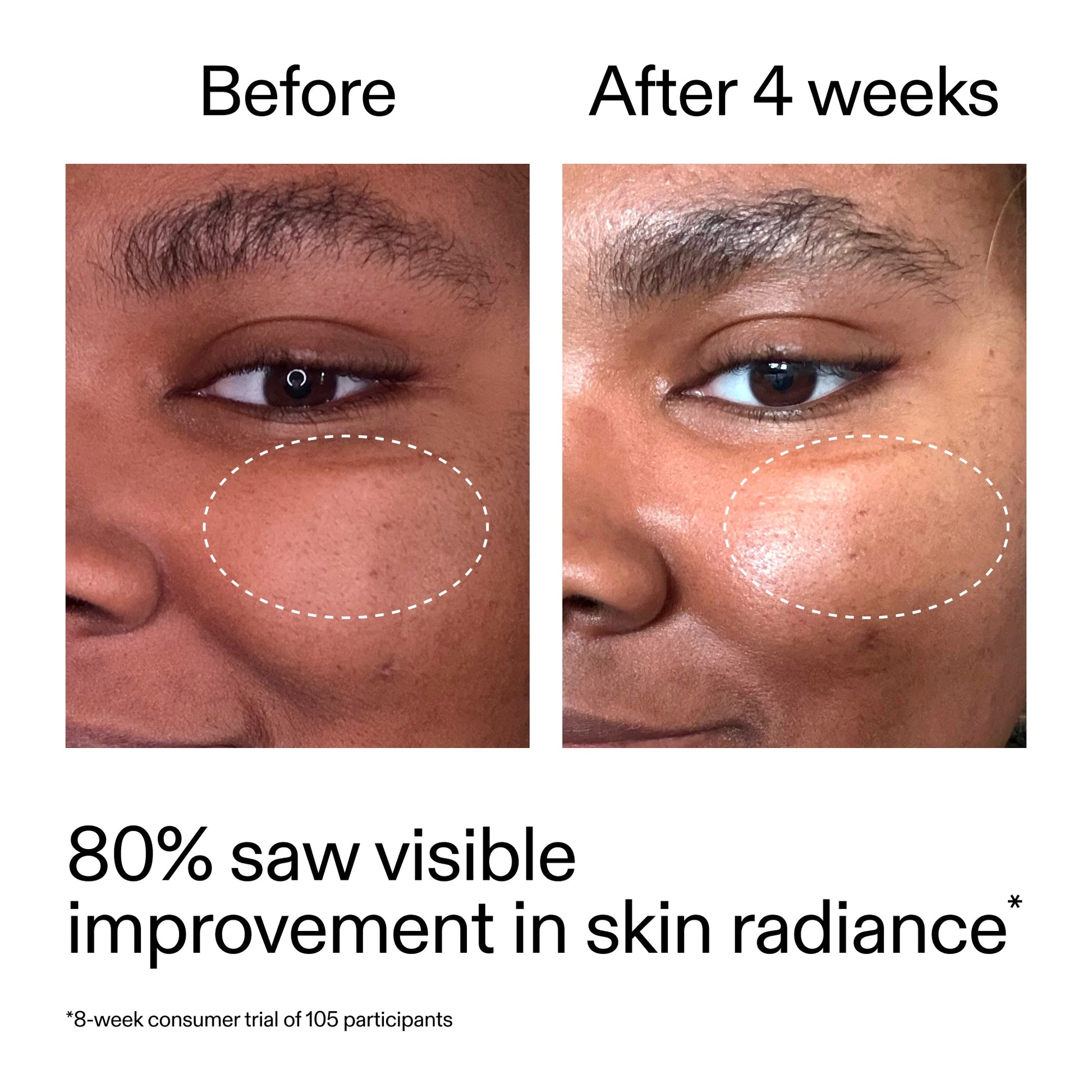 advanced-0-2-retinal-serum-z9 AdvancedRetinal_BeforeAfter_Claim2_2000x2000_39d11e3d-eda9-44ec-ab32-2903b1a368bd.jpg