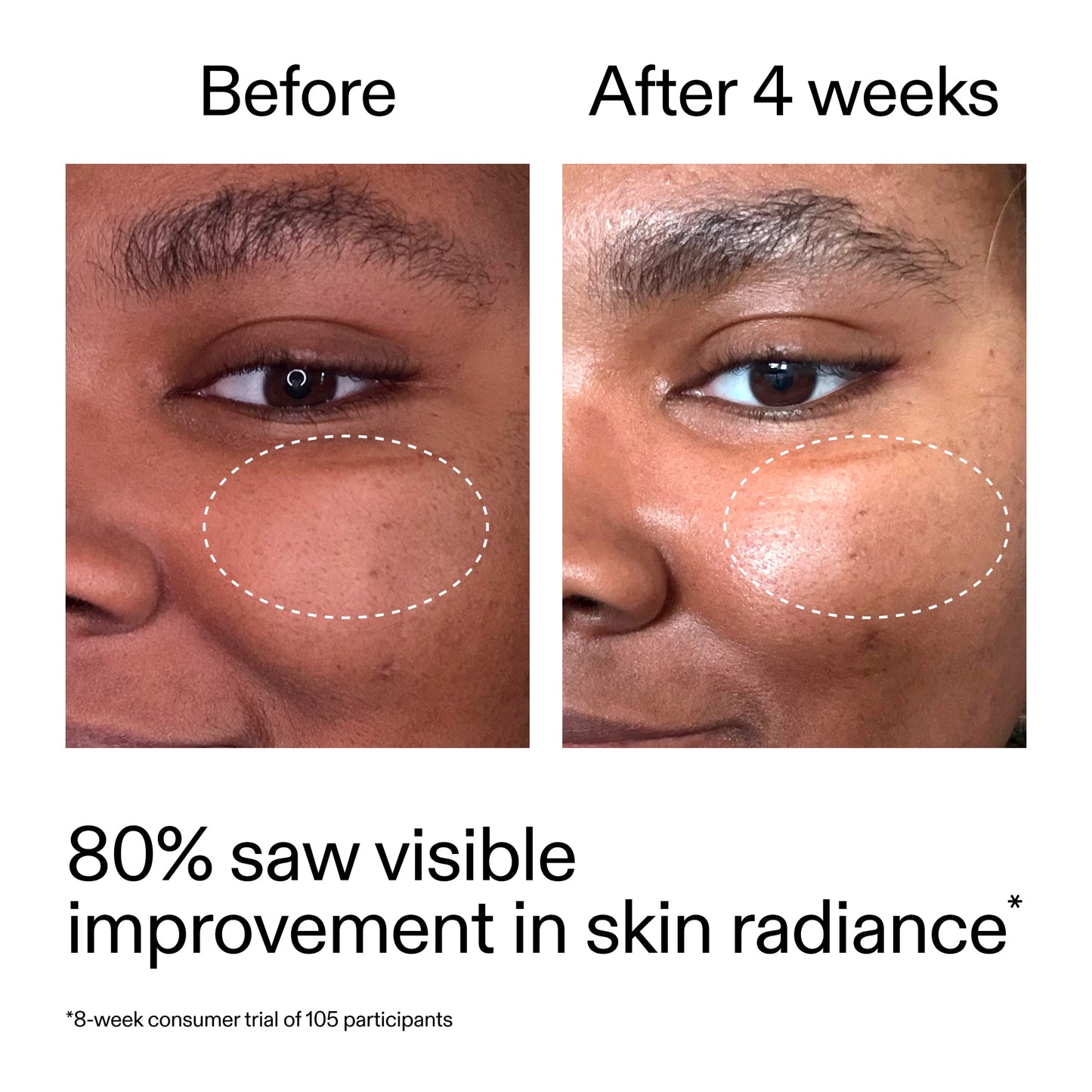 advanced-0-2-retinal-serum-duo-w4 AdvancedRetinal_BeforeAfter_Claim2_2000x2000_681b621d-8d44-4d44-9a40-89244f9b2e53.jpg