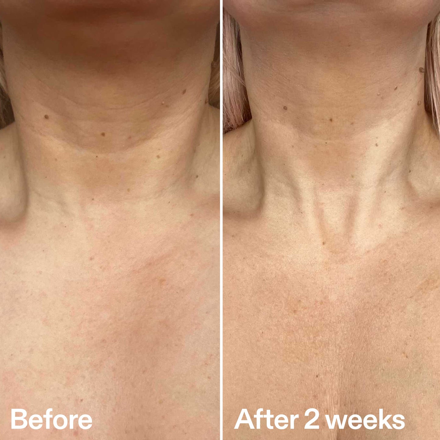 bio-active-neck-lift-stick-q2 B_A_2.jpg