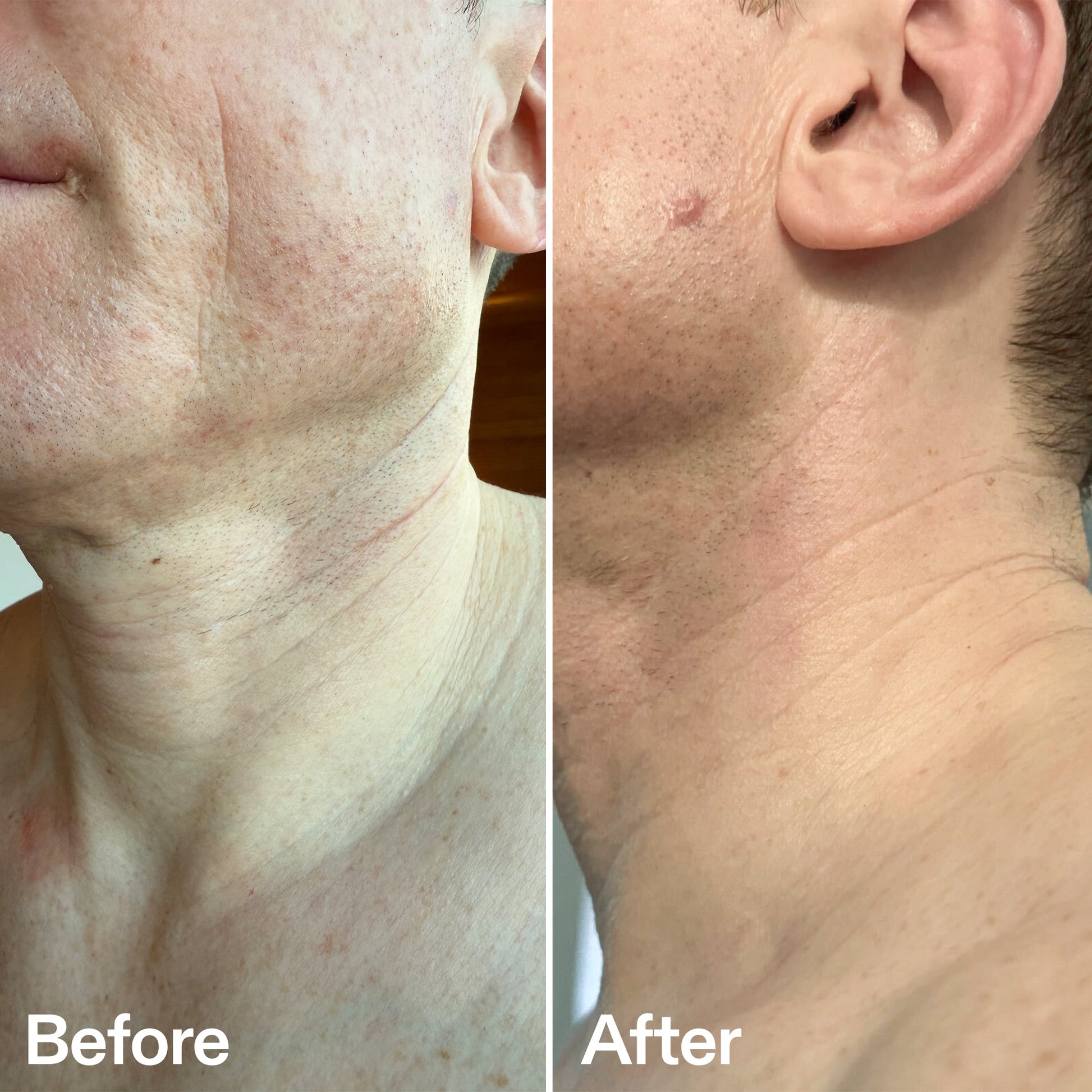 bio-active-neck-lift-stick-q2 B_A_afa2743e-b8e2-4504-92f4-e281cb6cf759.jpg