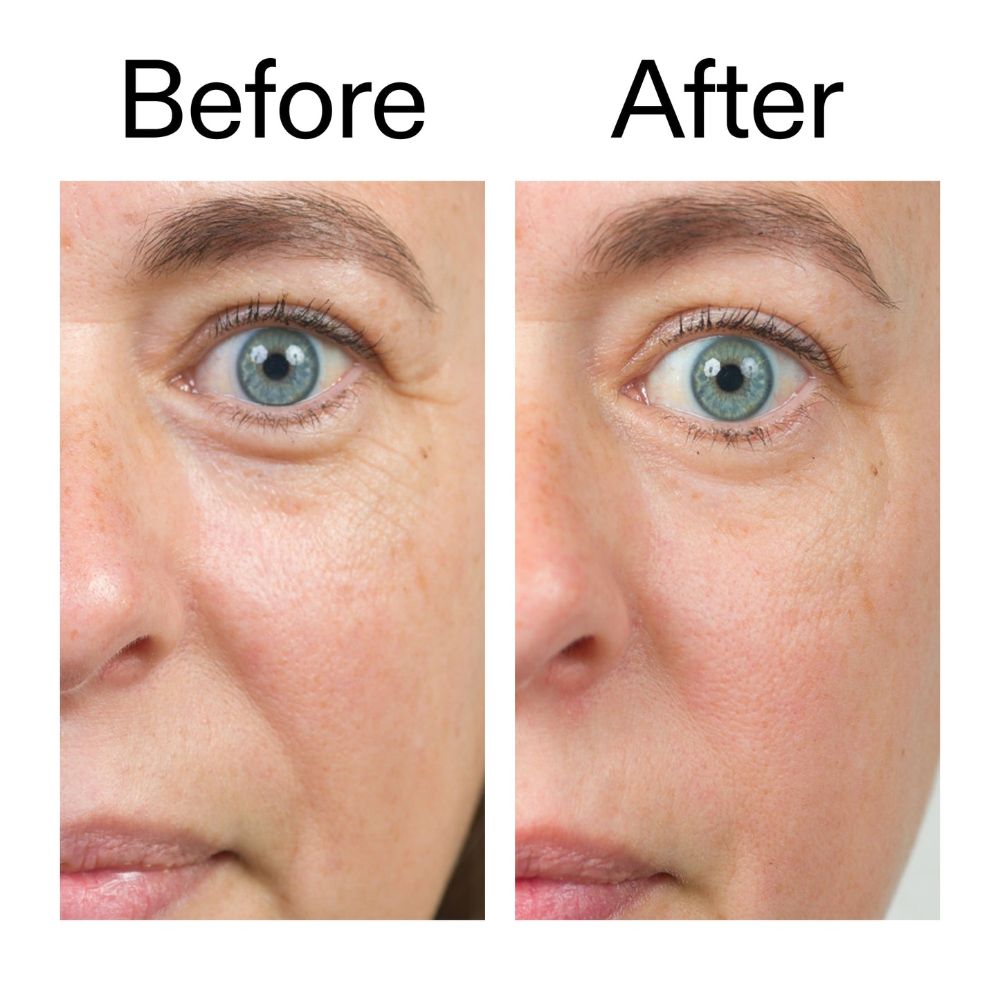 bio-active-ceramide-moisturizer-y7 Bio-Active_Before_After_2000x2000_566e5a9e-135e-417a-8242-b44e5fa35463.jpg