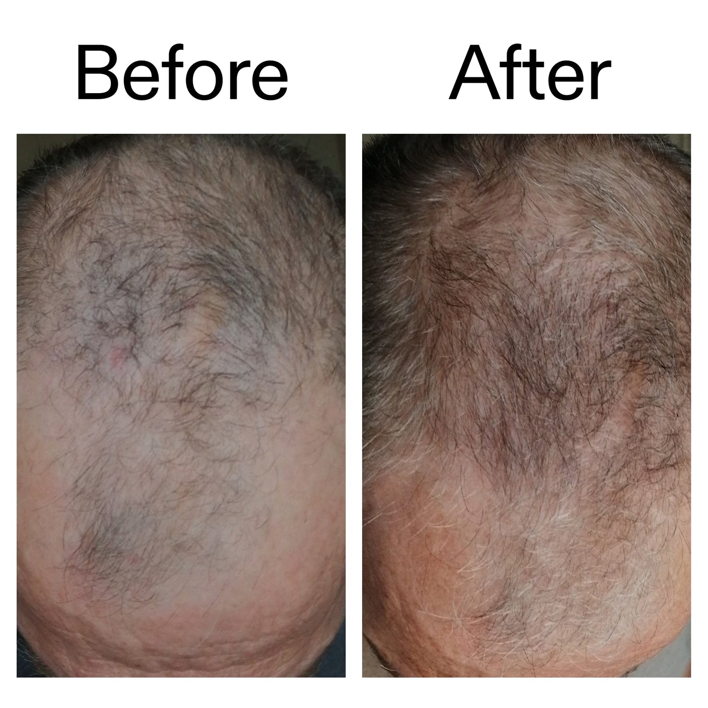 caffeine-stimulating-scalp-treatment-z3 Caffeine_Scalp_Treatment_B_A_Ppage_2000_x_2000.jpg