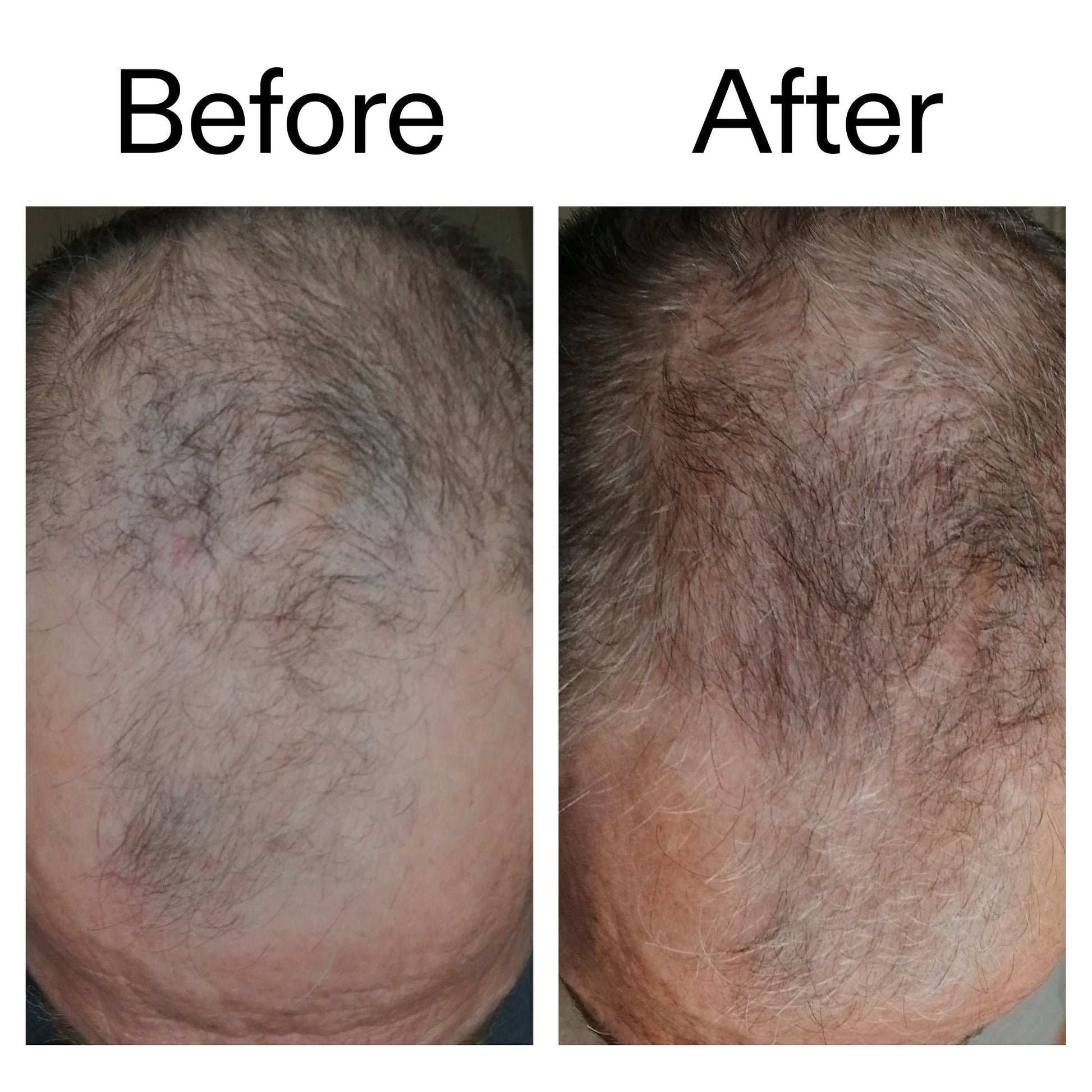 3-month-hair-growth-trio-t2 Caffeine_Scalp_Treatment_B_A_Ppage_2000_x_2000.jpg