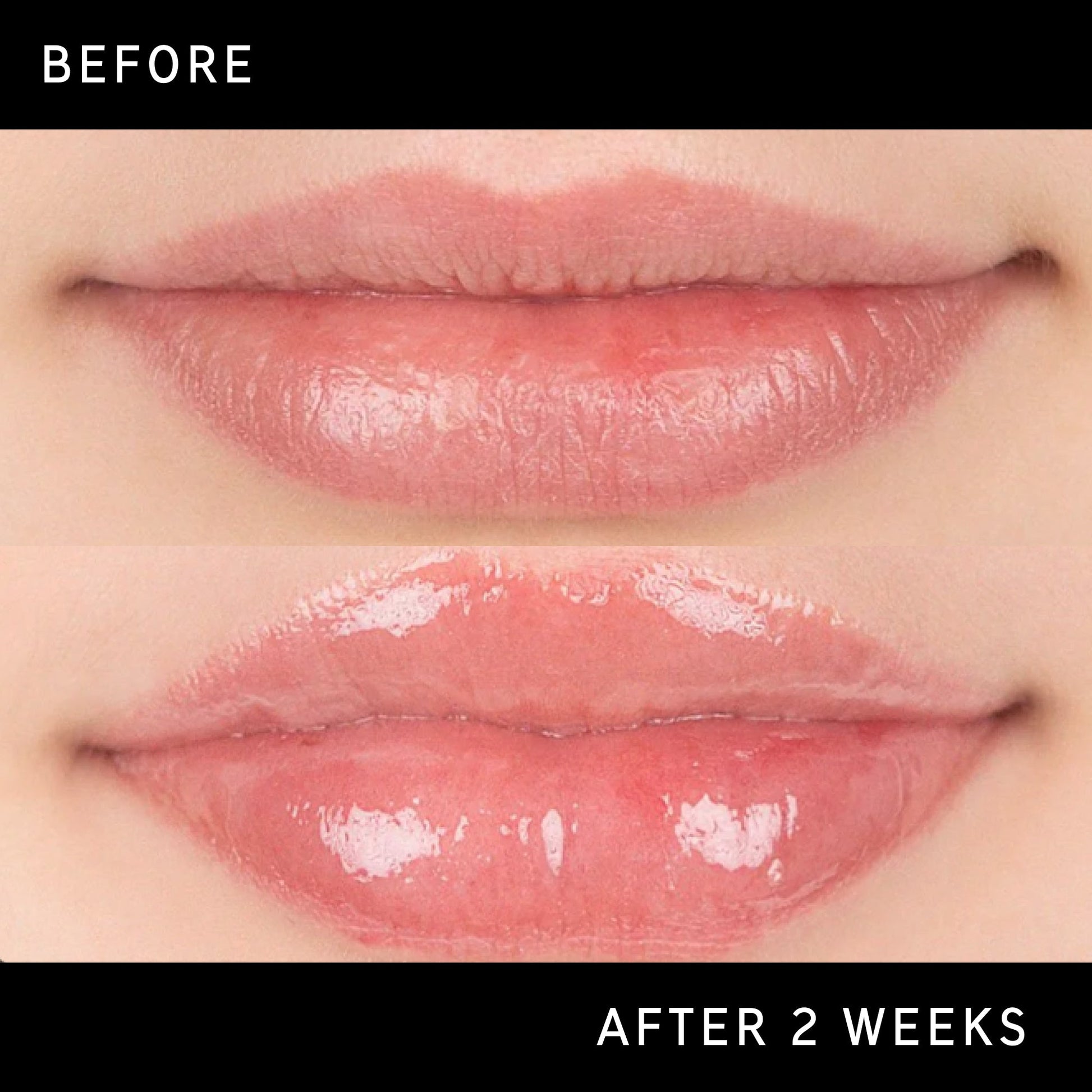 lip-plumping-duo-s2 DTC-Top15_Amends_Tripeptide-Lip_B_A.jpg
