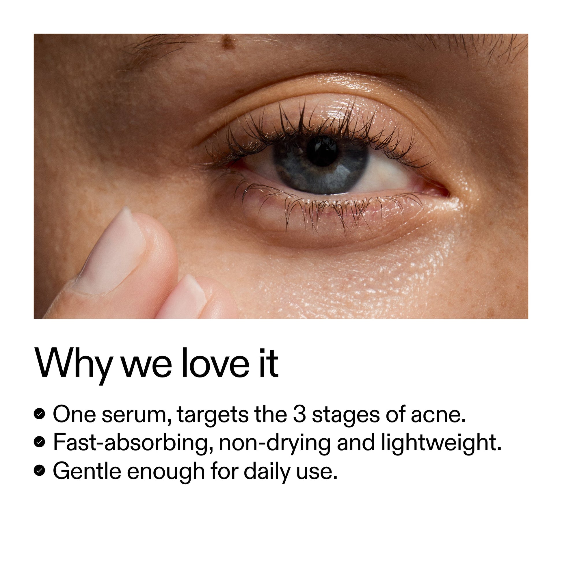 360-acne-clearing-duo-h7 Dioic_Whyweloveit_2000x2000_175aafd3-0cbe-403a-b317-a8362881bfe2.jpg