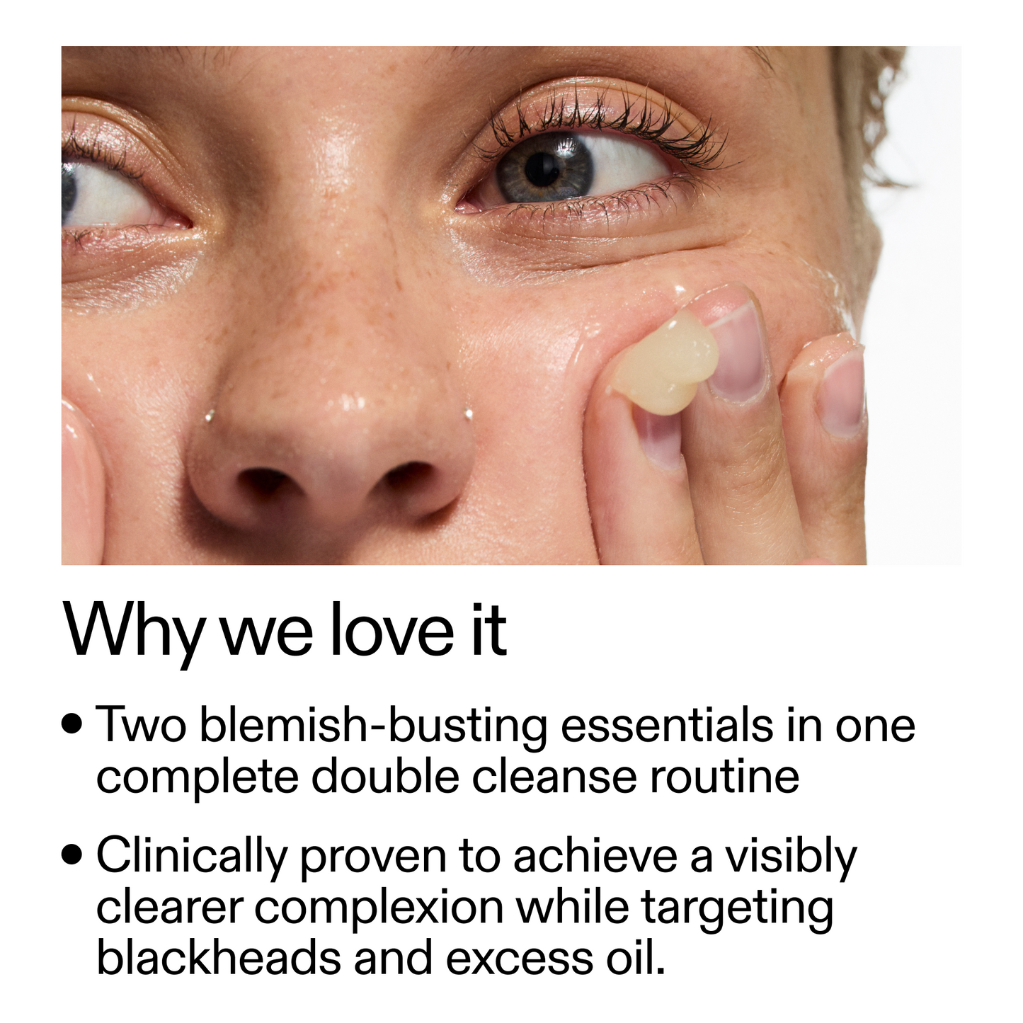 acne-double-cleanse-duo-m7 Double_Cleanse_Duo_for_Breakouts_Why_We_2000x2000_f242cb12-bb5c-487c-b203-071ccb406ec5.png