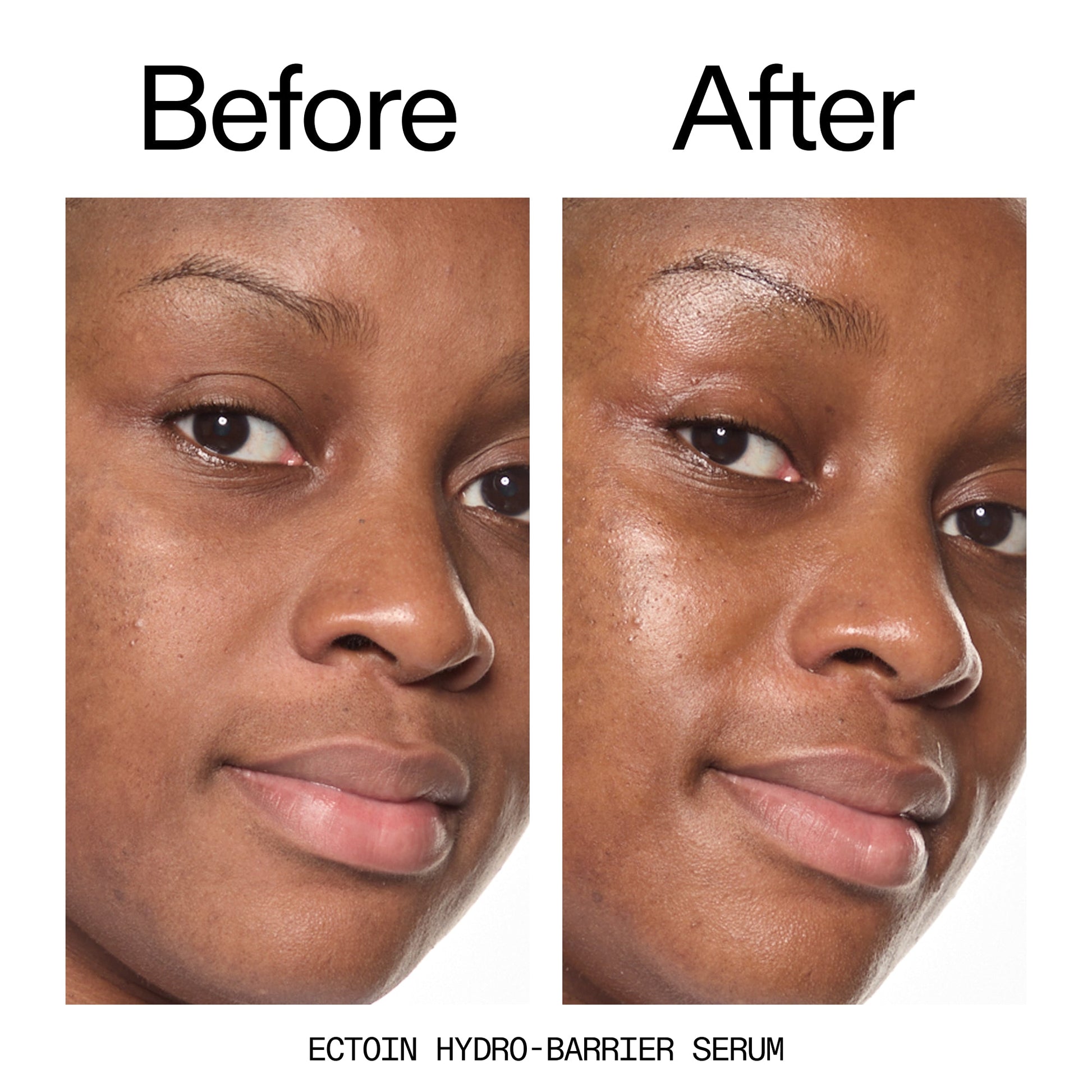 barrier-boosting-trio-l8 Ectoin_Before_After_2000x2000_ce35bc41-4da0-4b6f-adc7-29f8641f6c6c.jpg