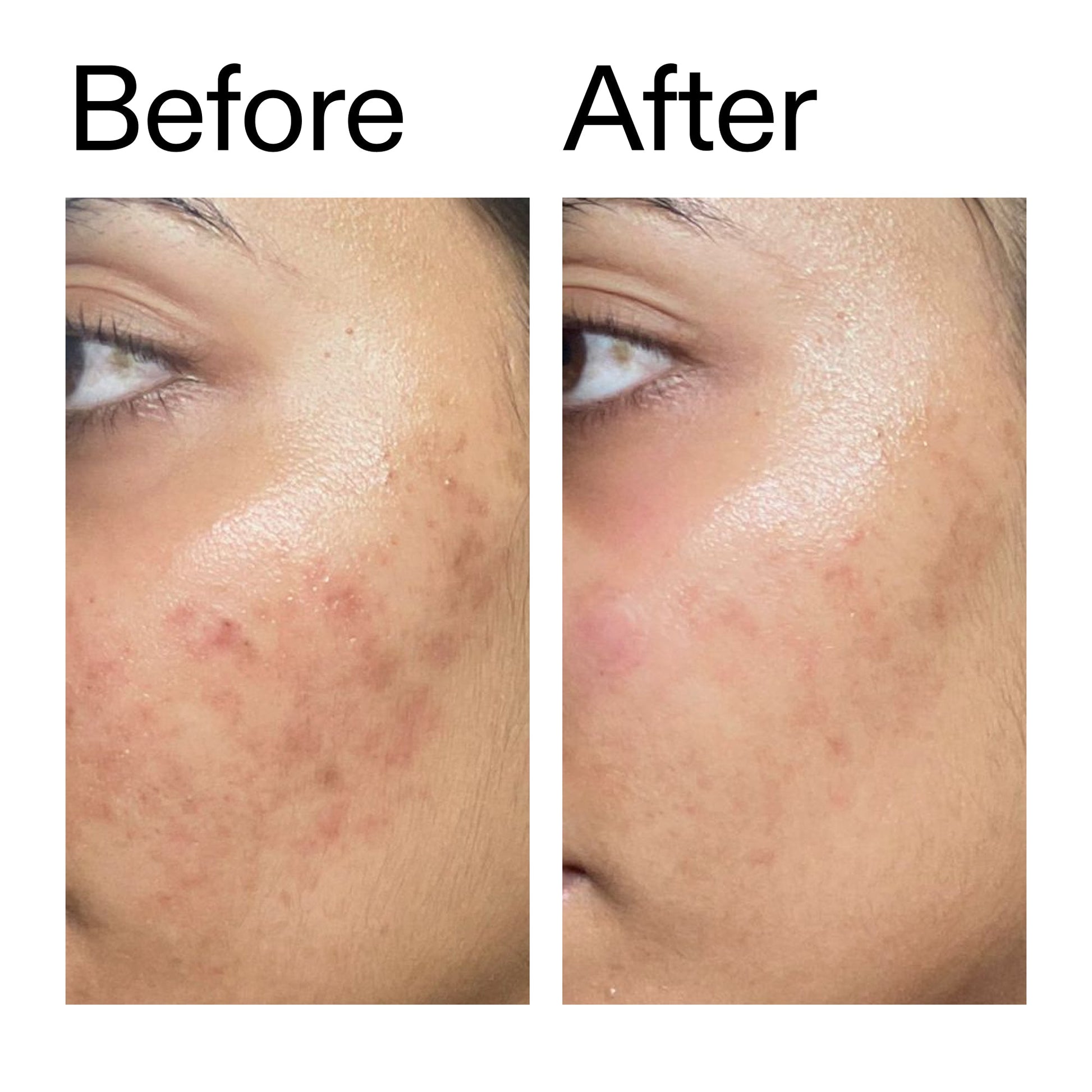 ectoin-hydro-barrier-serum-p0 Ectoin_Hydro-barrier_Serum__Before_After_2000x2000_34261920-d004-48d0-9c7b-8e1c15971bfd.jpg