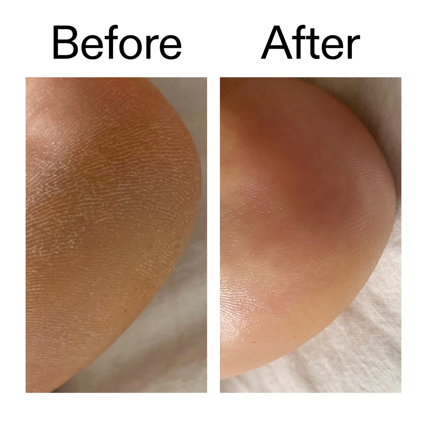 glycolic-acid-exfoliating-body-stick-n7 Glycolic_Acid_Exfoliating_Body_Stick_Before_After_V1_2000x2000_a3043625-9400-429a-a7fb-d6dbd220f722.jpg