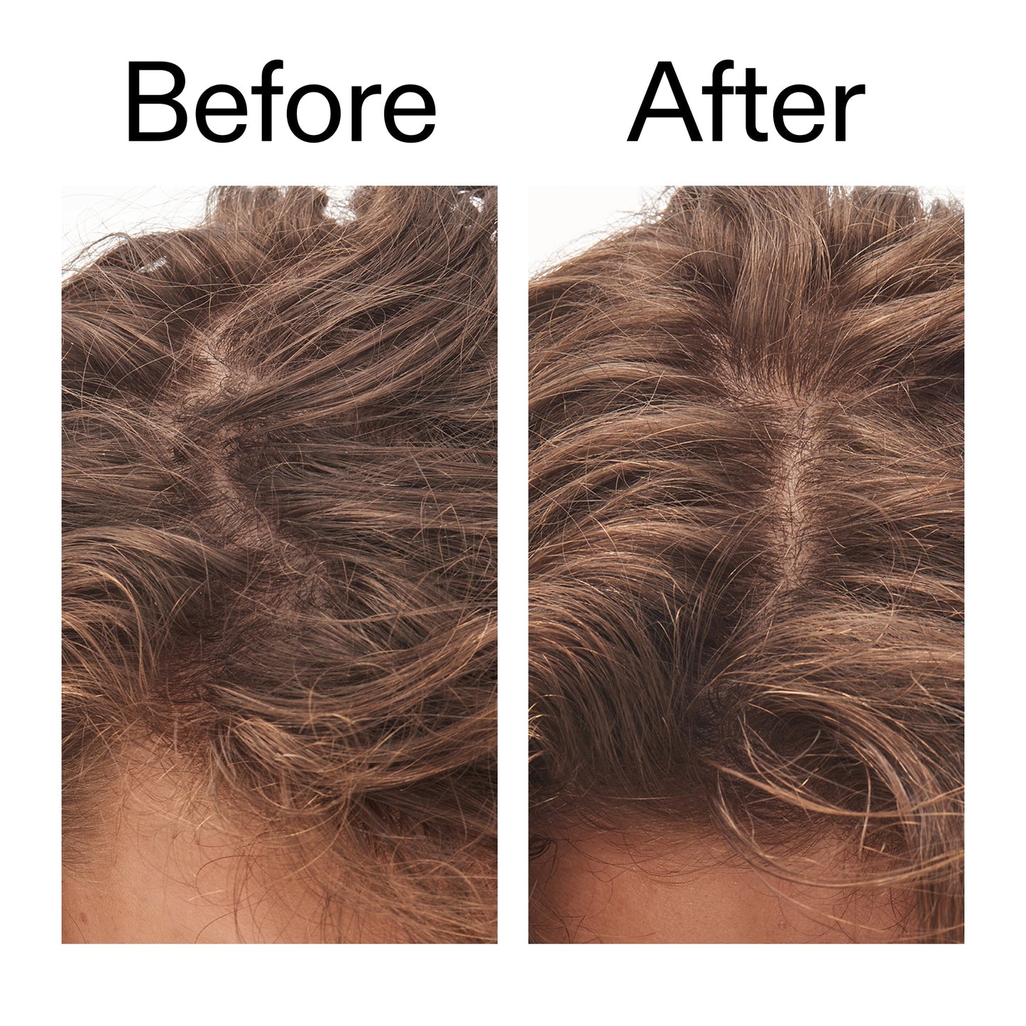glycolic-acid-exfoliating-scalp-scrub-s4 Glycolic_Acid_Exfoliating_Scalp_Scrub_Before_After_2000x2000_b8561c87-05a1-4caa-80f7-1b6b33d750f7.jpg