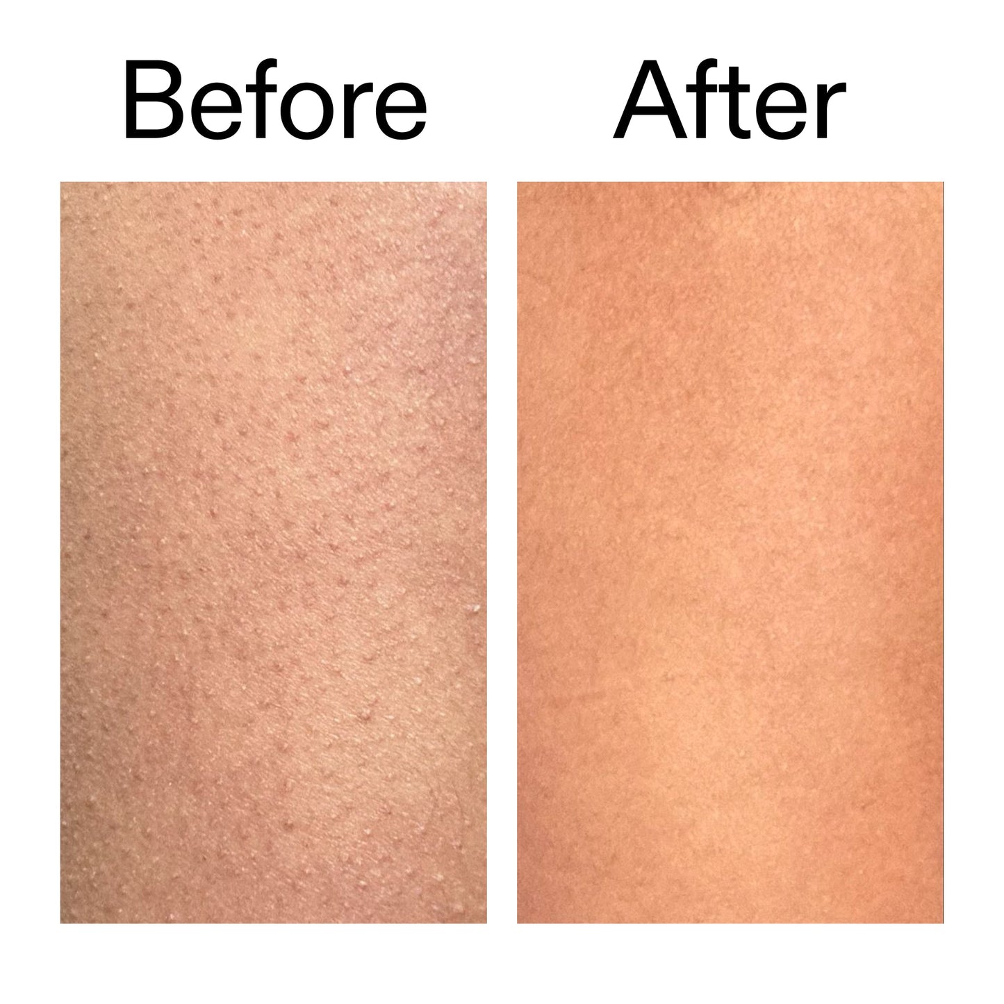 glycolic-acid-exfoliating-body-stick-n7 Glycolic_Body_Stick_B_A_2000x2000_6e6e6b4d-5bd7-43c0-aeed-4d66788e8995.jpg