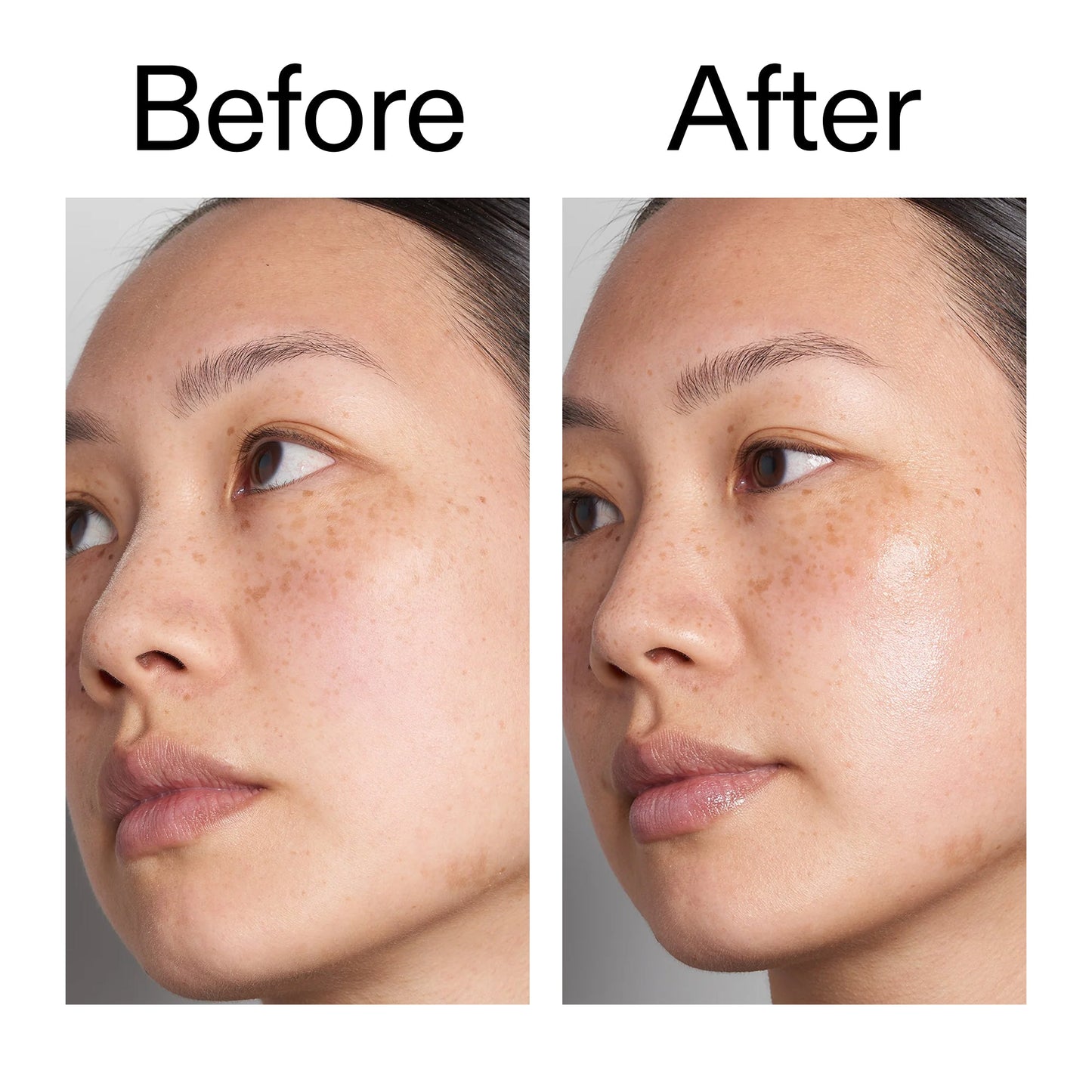 hyaluronic-acid-serum-30ml-r5 Hyaluronic_Acid_Before_After_2000x2000_d7983956-8aa2-4ea3-8255-c63e8d4f892e.jpg