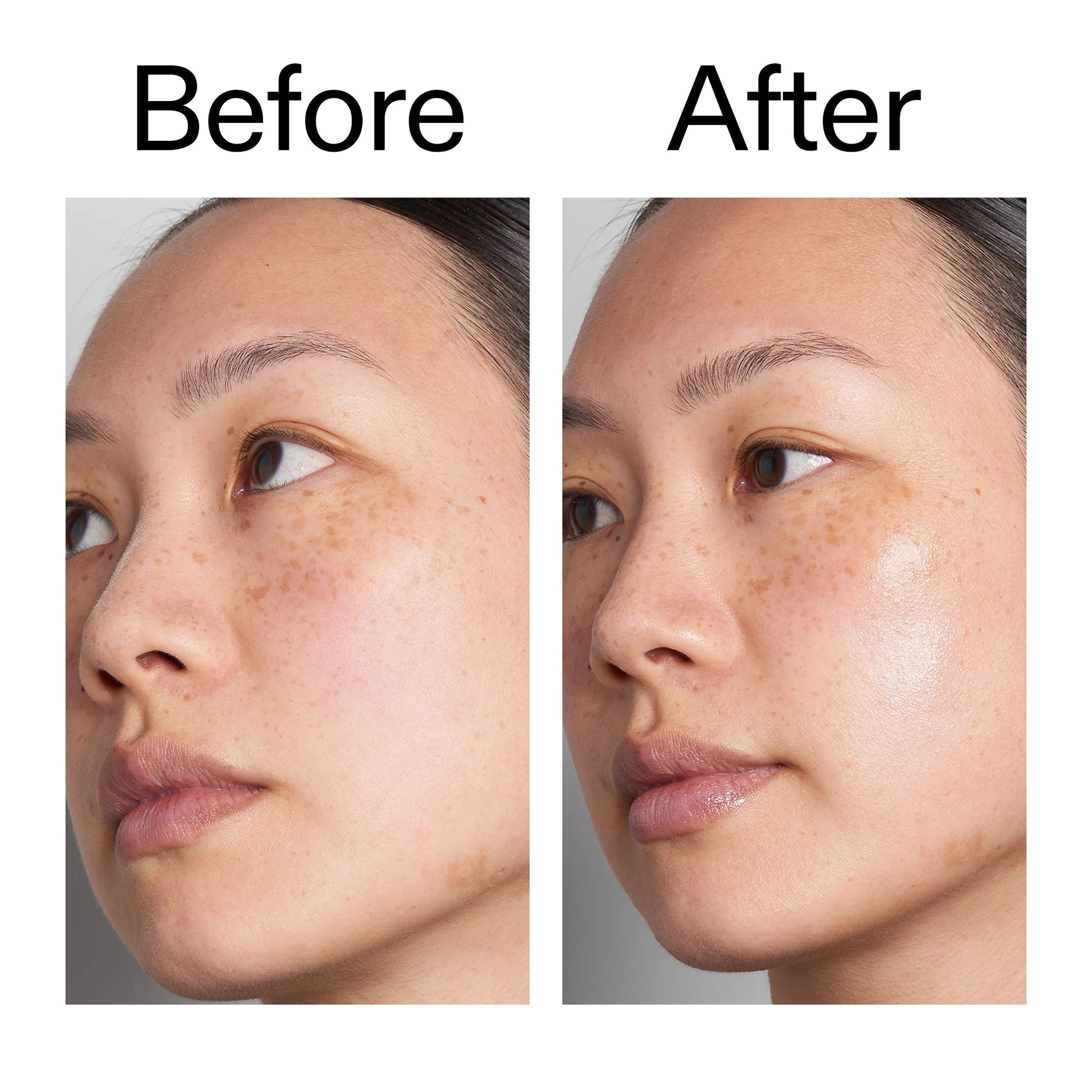 supersize-hyaluronic-acid-serum-100ml-duo-h5 Hyaluronic_Acid_Before_After_2000x2000_d7983956-8aa2-4ea3-8255-c63e8d4f892e.jpg