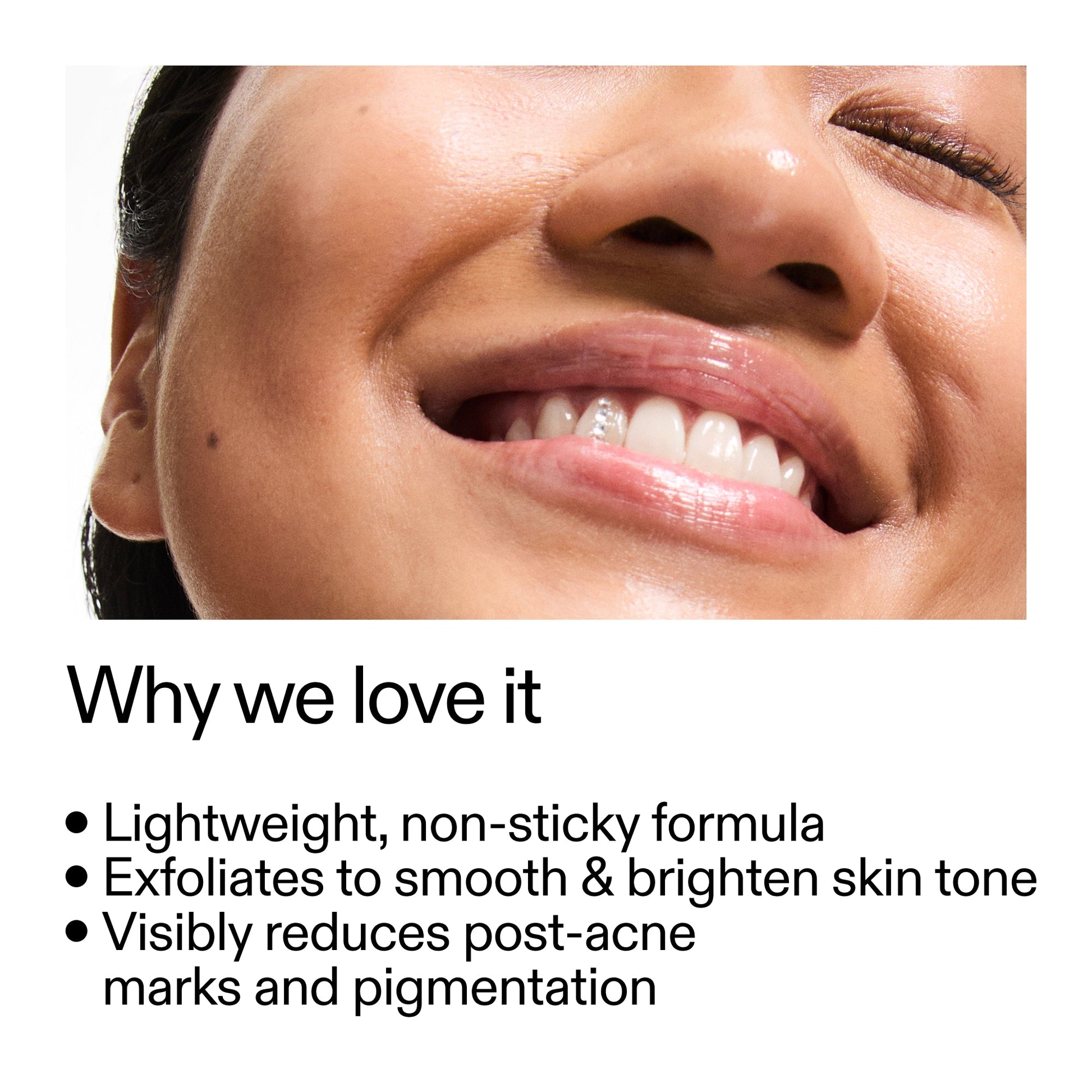 mandelic-acid-treatment-t5 Mandelic_Acid_Treatment_Why_we_love_it_2000x2000_6dfe29a9-2a79-464f-a5e8-e5ac37d93388.jpg