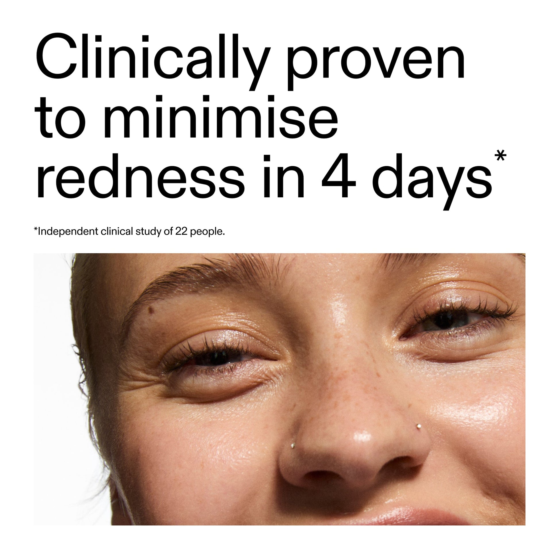 10-azelaic-acid-serum-for-redness-relief-u1 Oat_Cleansing_Balm_Claim_2000x2000_52a841dc-353c-4f2c-8646-3aadb604507d.jpg