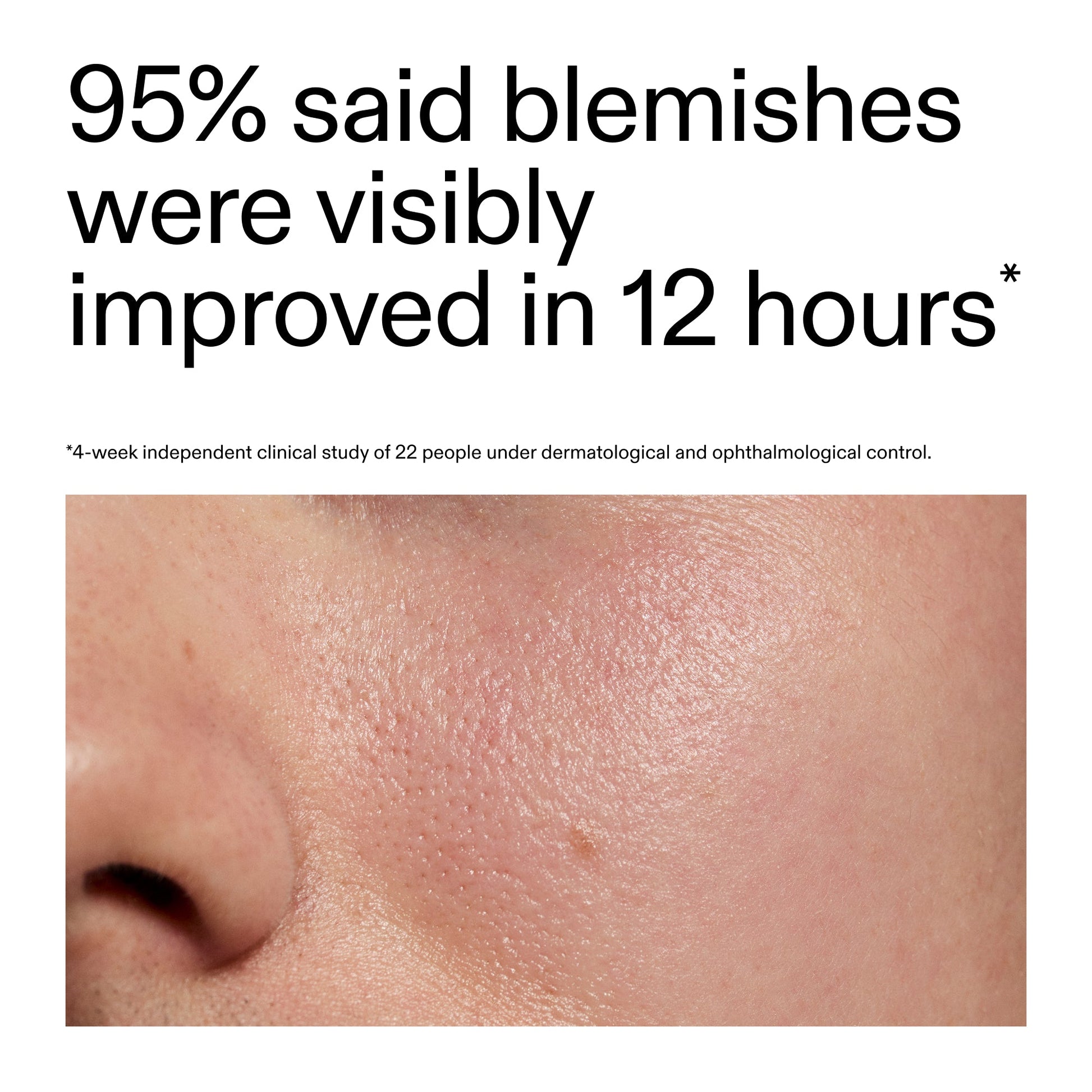 succinic-acid-acne-treatment-t6 Oat_Cleansing_Balm_Claim_2000x2000_ac6ce553-25db-41b2-a981-faae1ac4b8c0.jpg