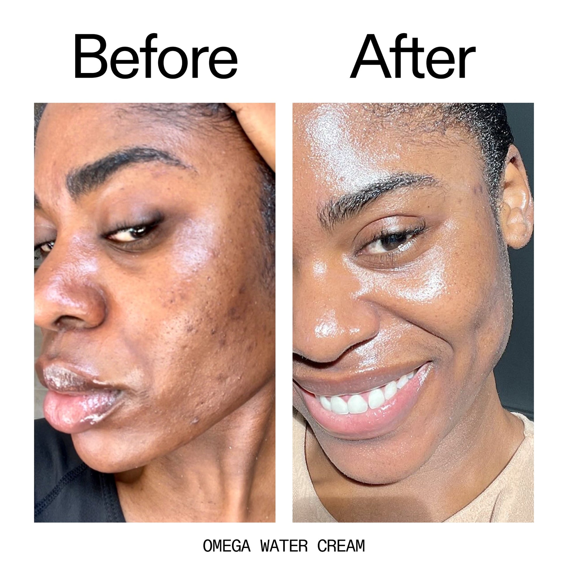 glowing-skin-set-v3 Omega_Water_Cream_Before_After_2000x2000_8e88278b-8c8d-48dc-ac77-4e98ebbd1b77.jpg