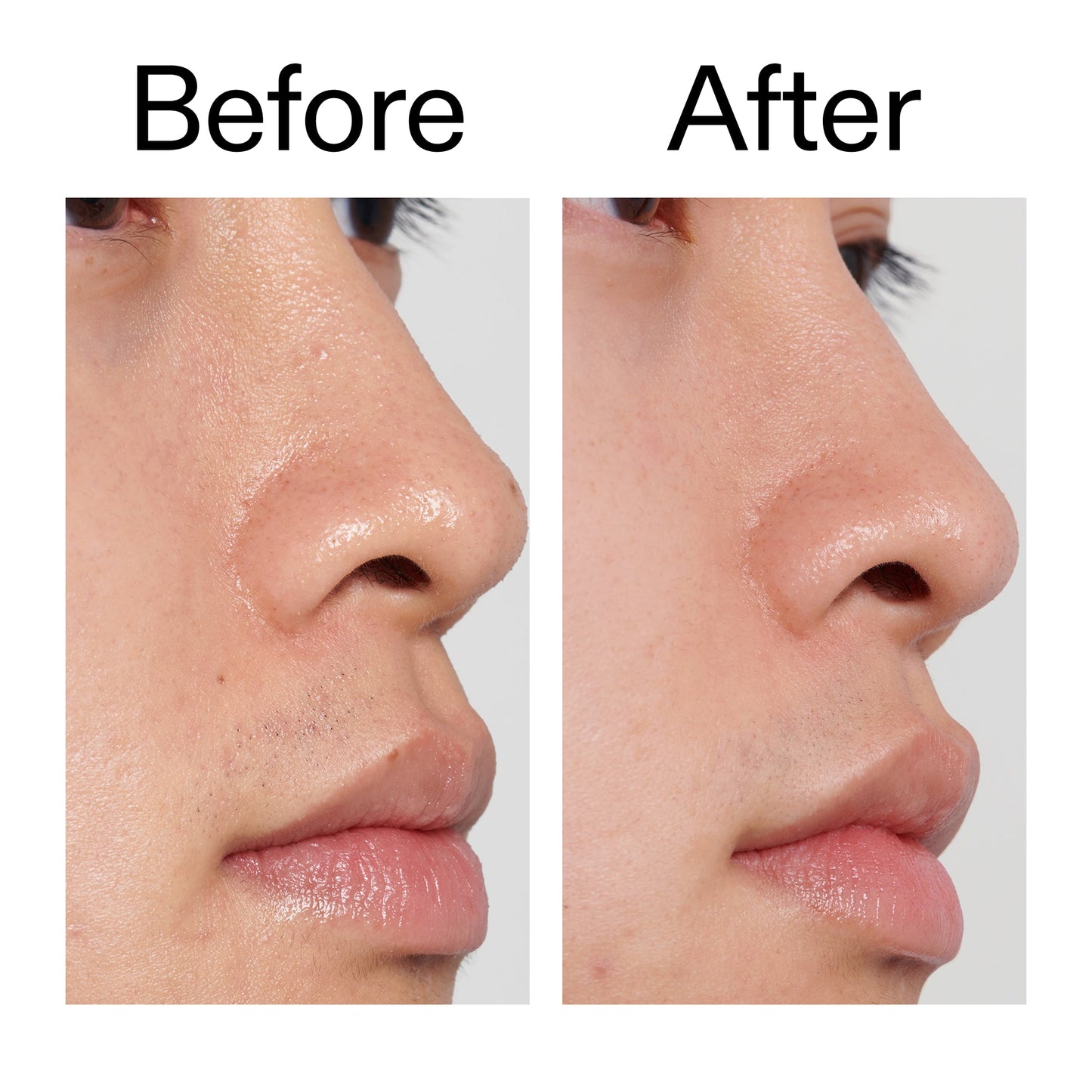 pha-toner-s1 PHA_Toner_Before_After_2000x2000_e3c10172-0150-4342-8b95-57417eaff50d.jpg