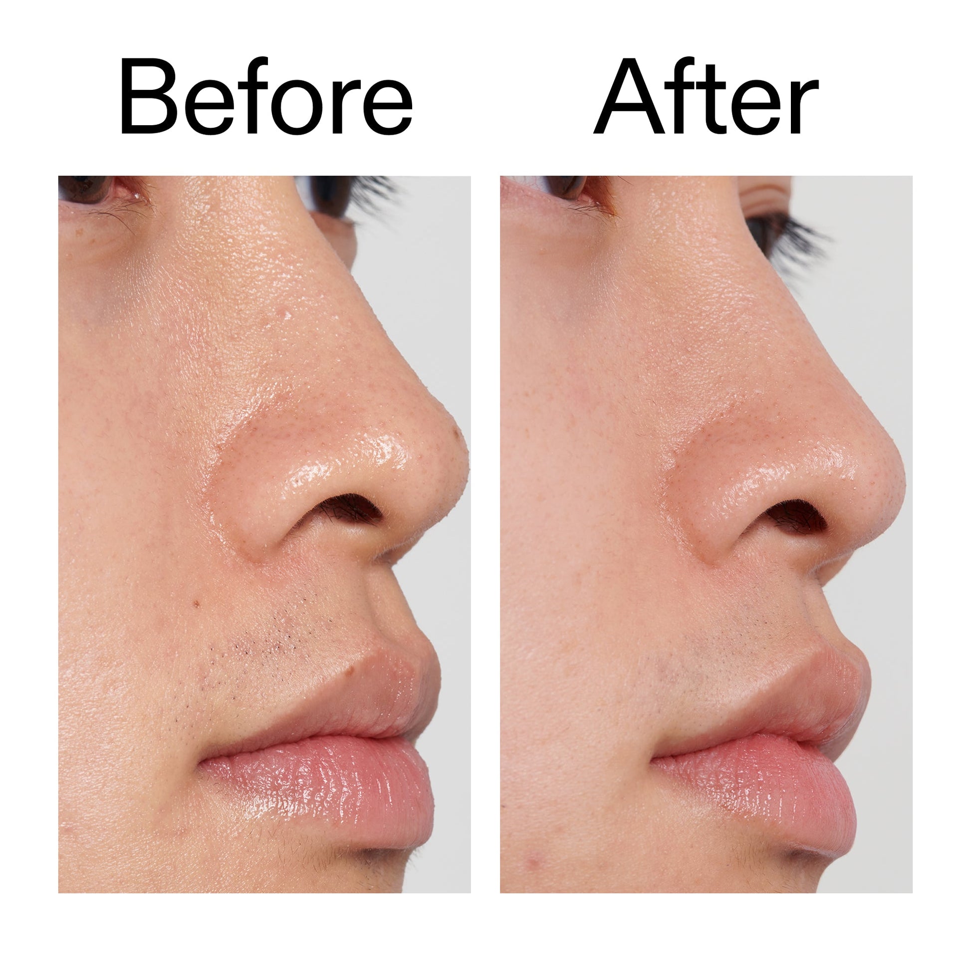 pha-toner-s1 PHA_Toner_Before_After_2000x2000_e3c10172-0150-4342-8b95-57417eaff50d.jpg