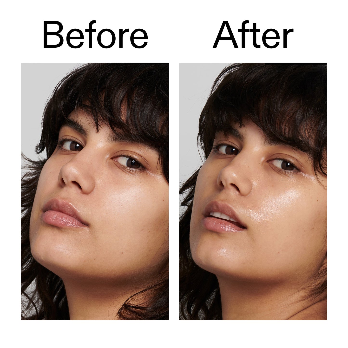 polyglutamic-acid-serum-f5 Polyglutamic_Acid_Serum_Before_After_2000x2000_dc0e1f71-d72b-4358-9c3a-ae43ead715d6.jpg