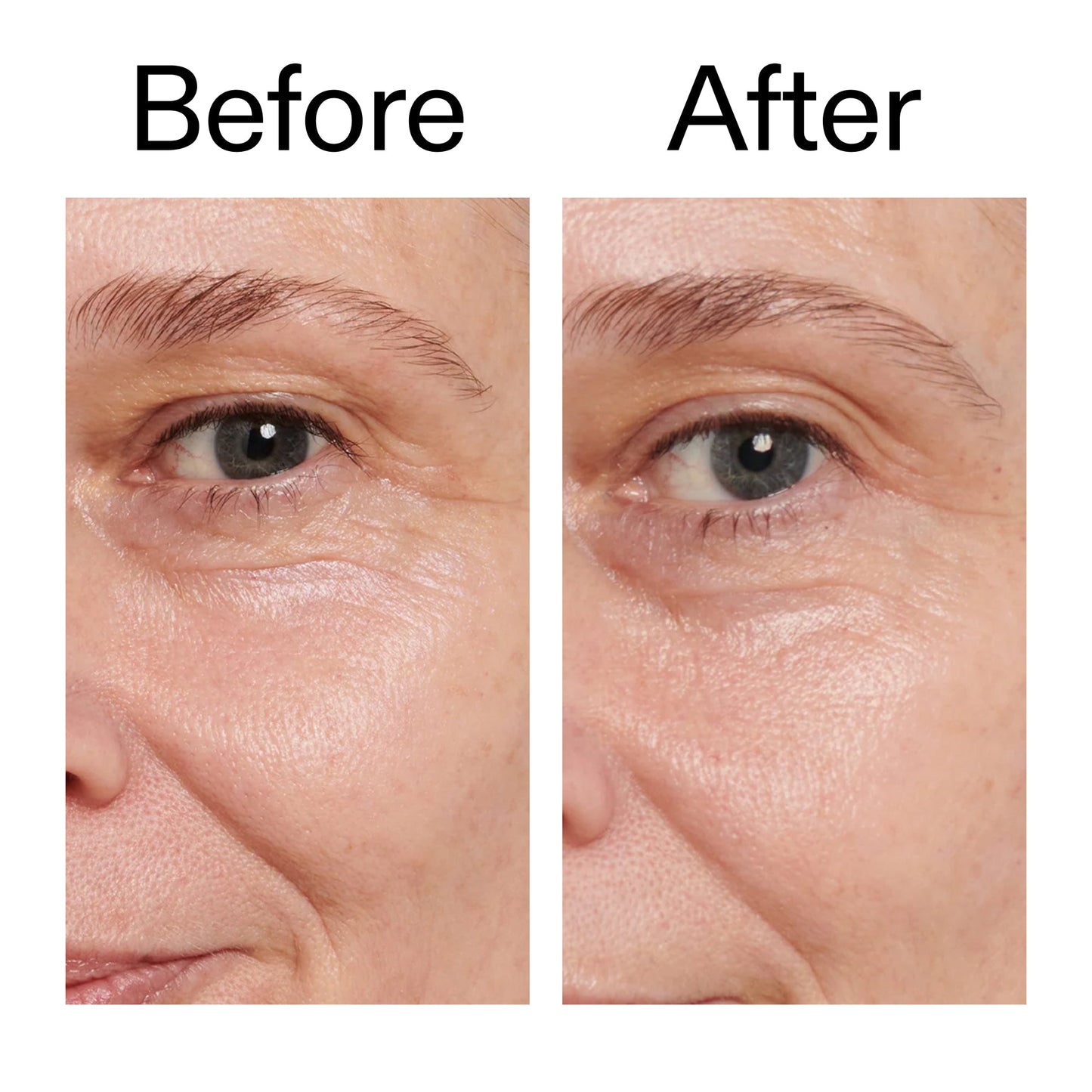 retinol-eye-cream-f9 Retinol_Eye_Cream_Before_After_2000x2000_ac03a80c-109e-4572-a95a-91dc109b4d27.jpg