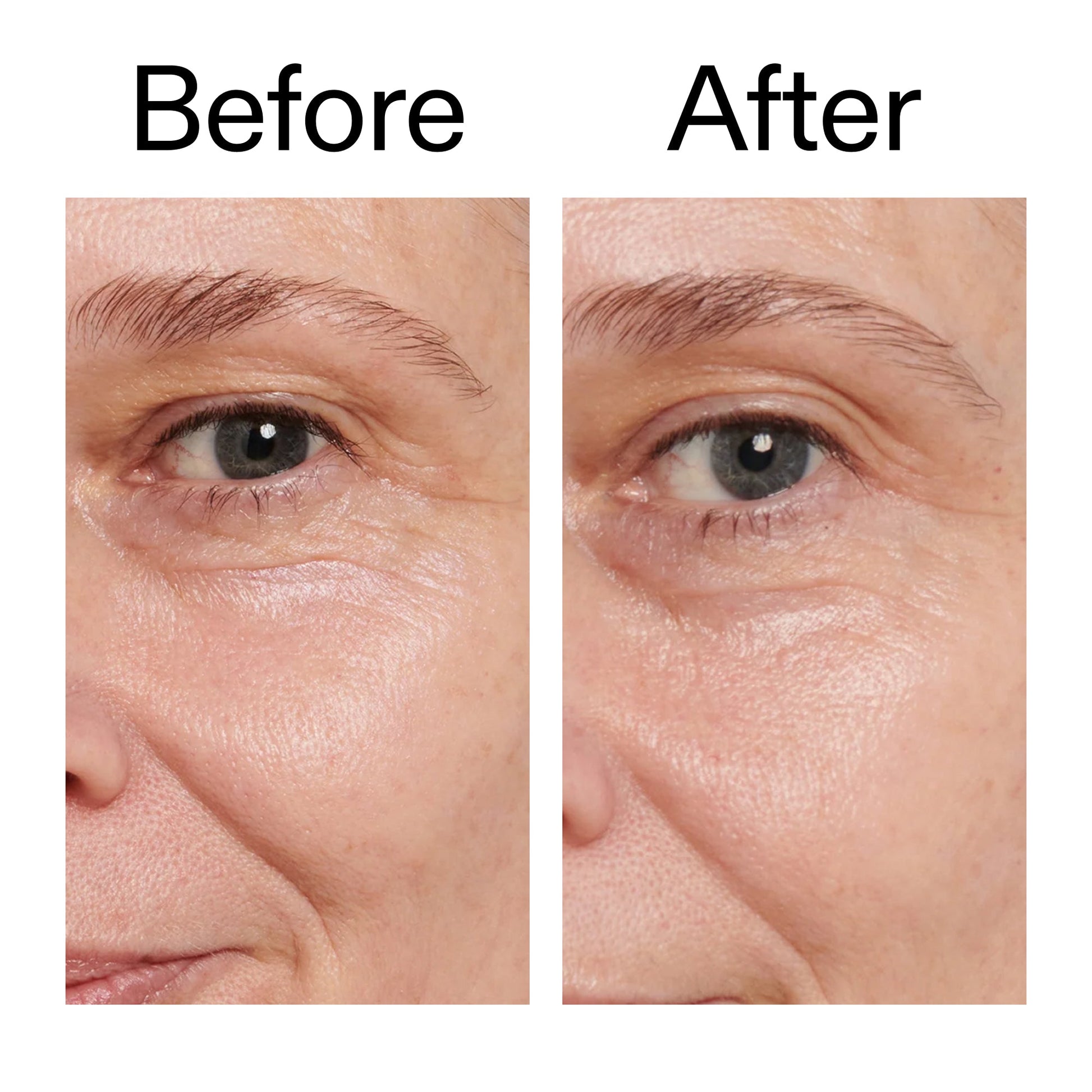 retinol-eye-cream-f9 Retinol_Eye_Cream_Before_After_2000x2000_ac03a80c-109e-4572-a95a-91dc109b4d27.jpg