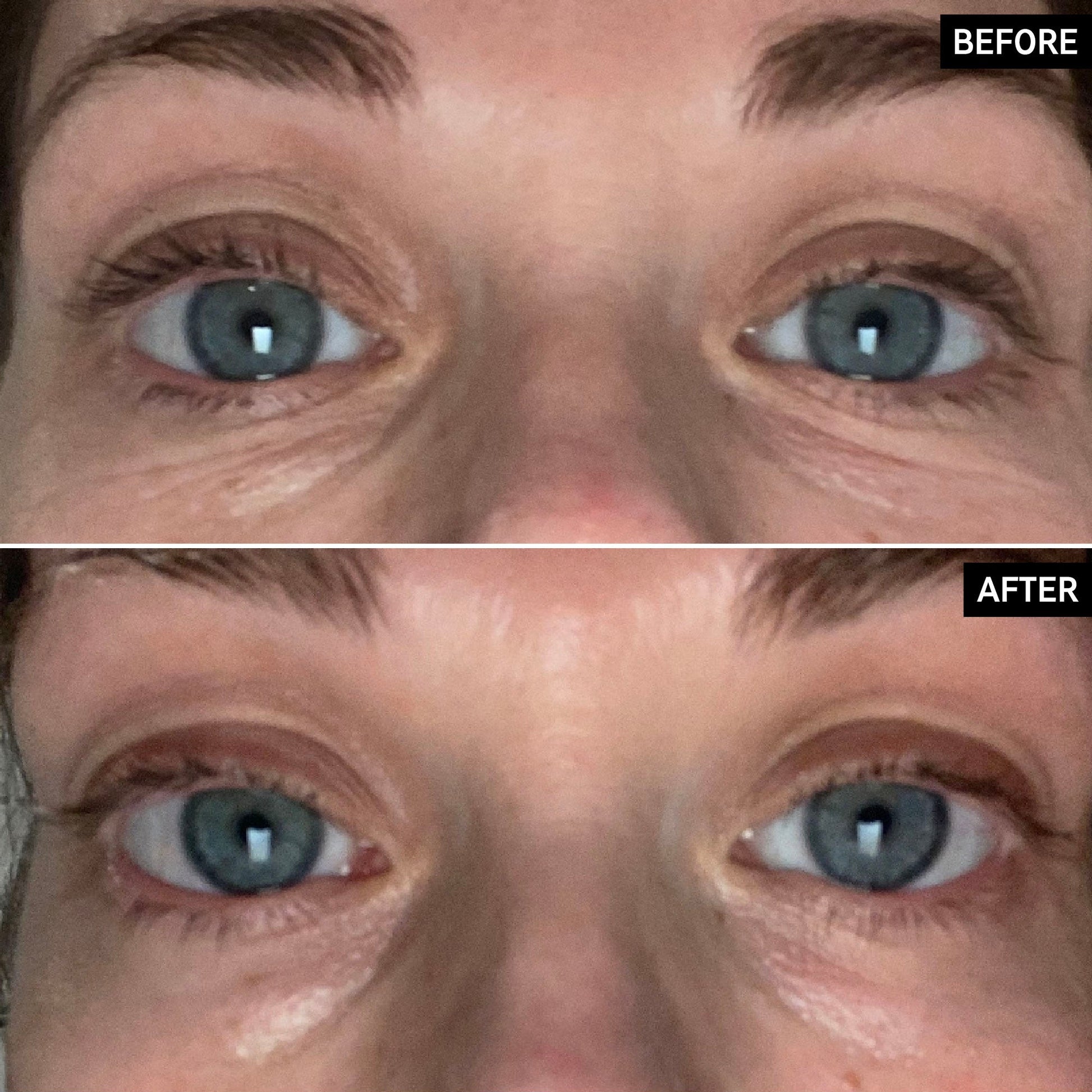 retinol-eye-cream-f9 SITE-UGCBAsApril_Nicole_B_A_PPage_2000x2000_1.jpg