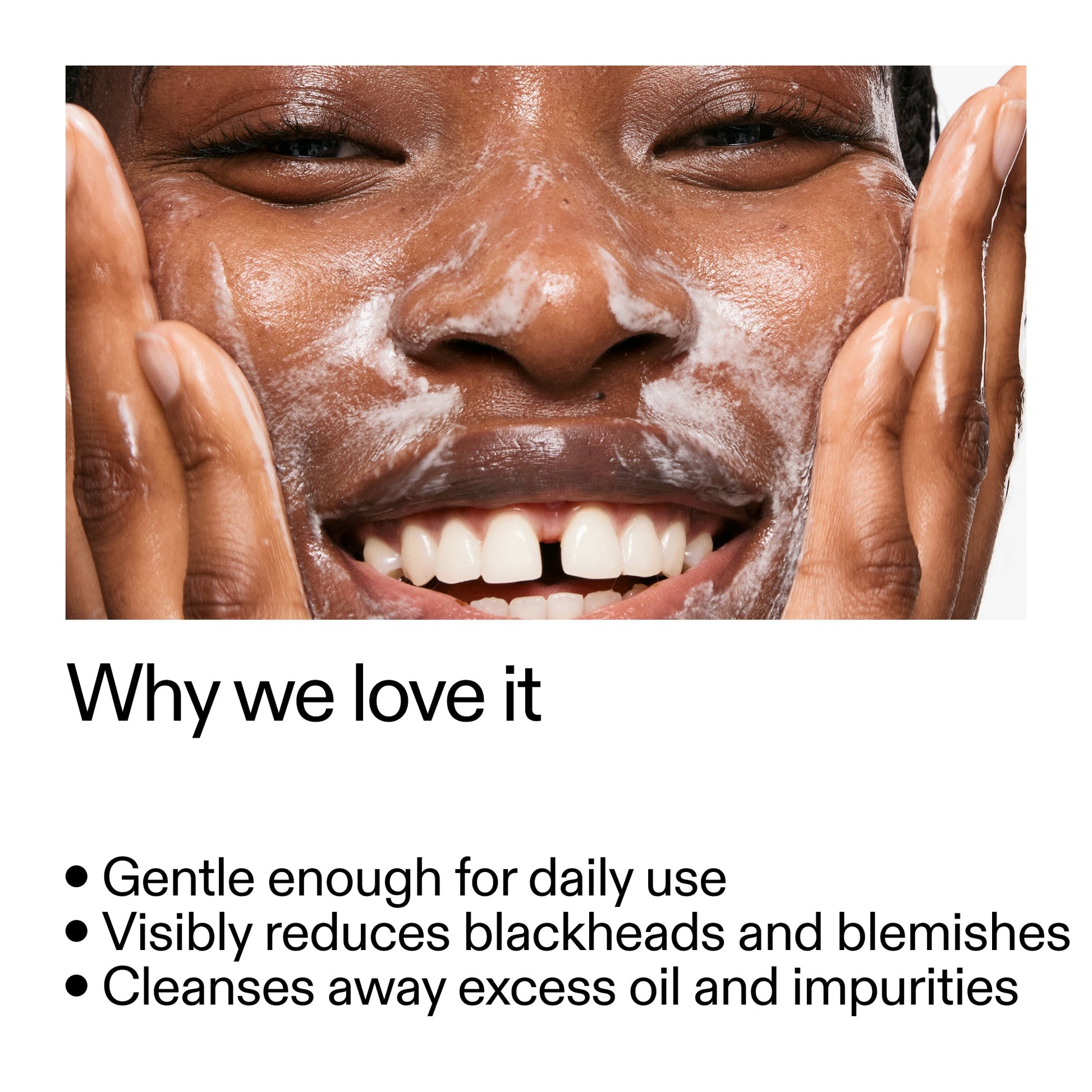 salicylic-acid-cleanser-duo-a5 Salicylic_Acid_Cleanser_-_300mlWhy_we_love_it_2000x2000_87dc92a9-2559-4309-98cd-4e570f1be735.jpg