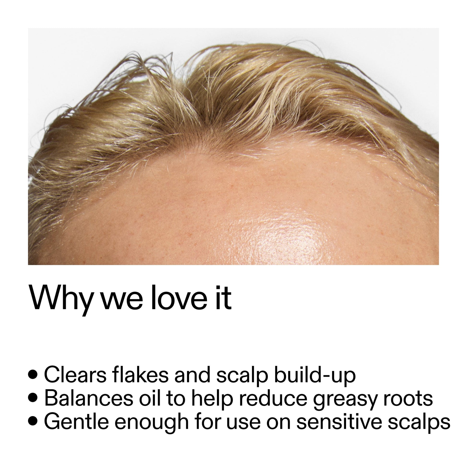 salicylic-acid-exfoliating-scalp-treatment-g9 Salicylic_Acid_Exfoliating_Scalp_Treatment_Why_we_love_it_2000x2000_44b6bd6d-9ec4-4b23-9dc4-bc3fd6f28e14.jpg