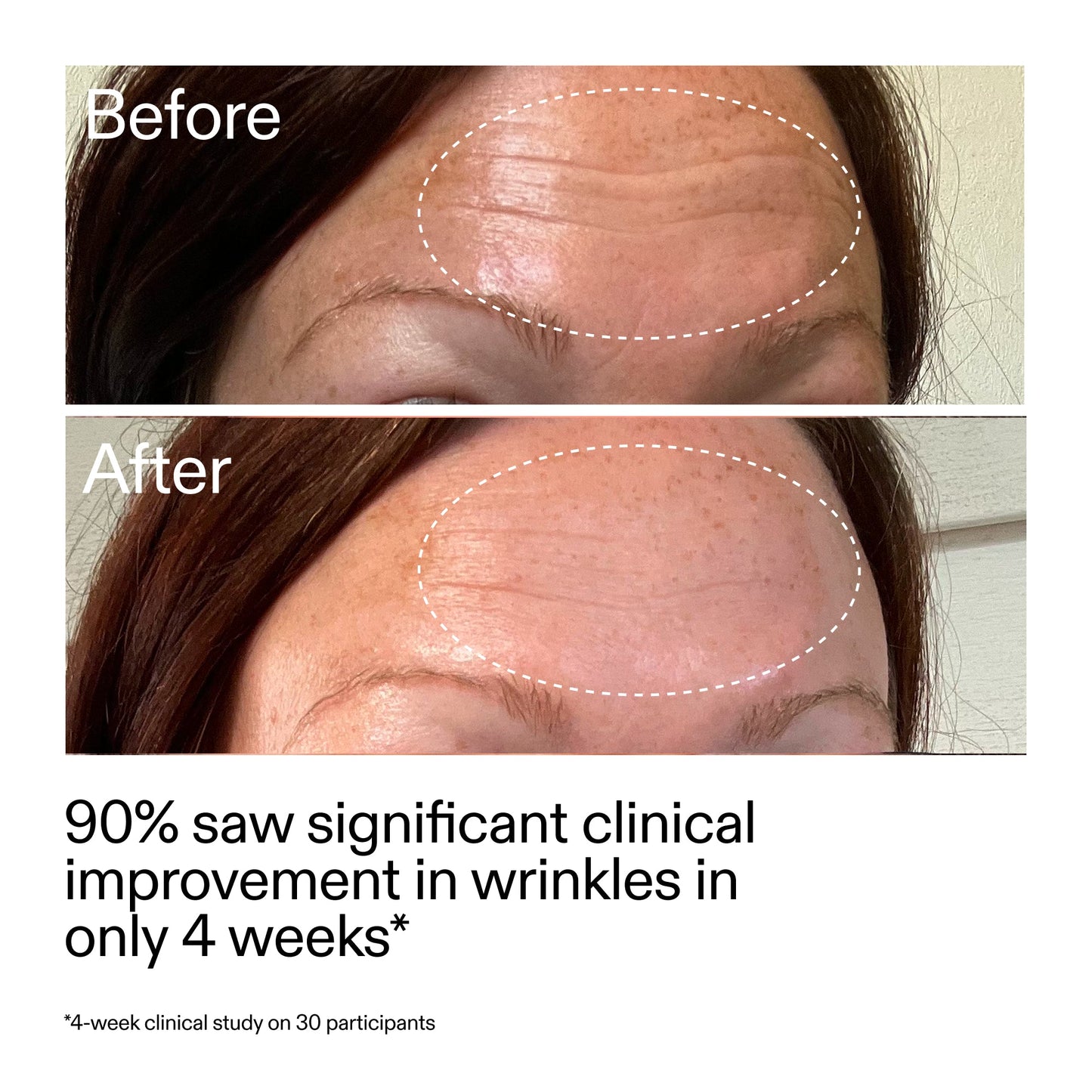 starter-retinol-serum-b7 StarterRetinol_BeforeAfter_Claim1_2000x2000_a09b50b6-4688-4527-abae-21bd142b89b7.jpg