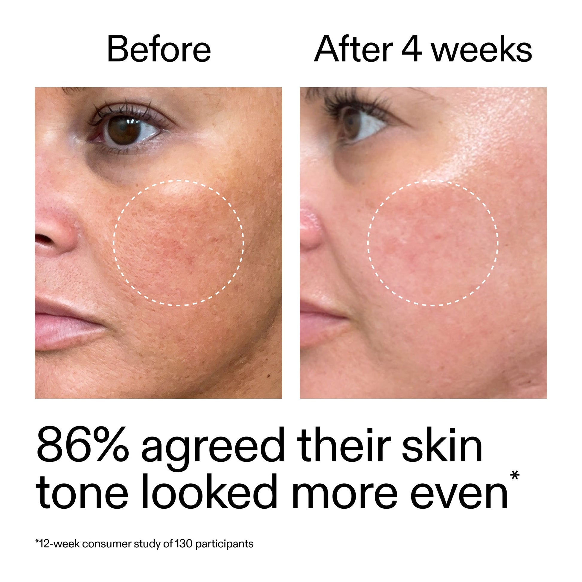 starter-retinol-serum-b7 StarterRetinol_BeforeAfter_Claim2_2000x2000_f5c9ecc0-8d76-429d-bef5-c3a61bcf5c09.jpg