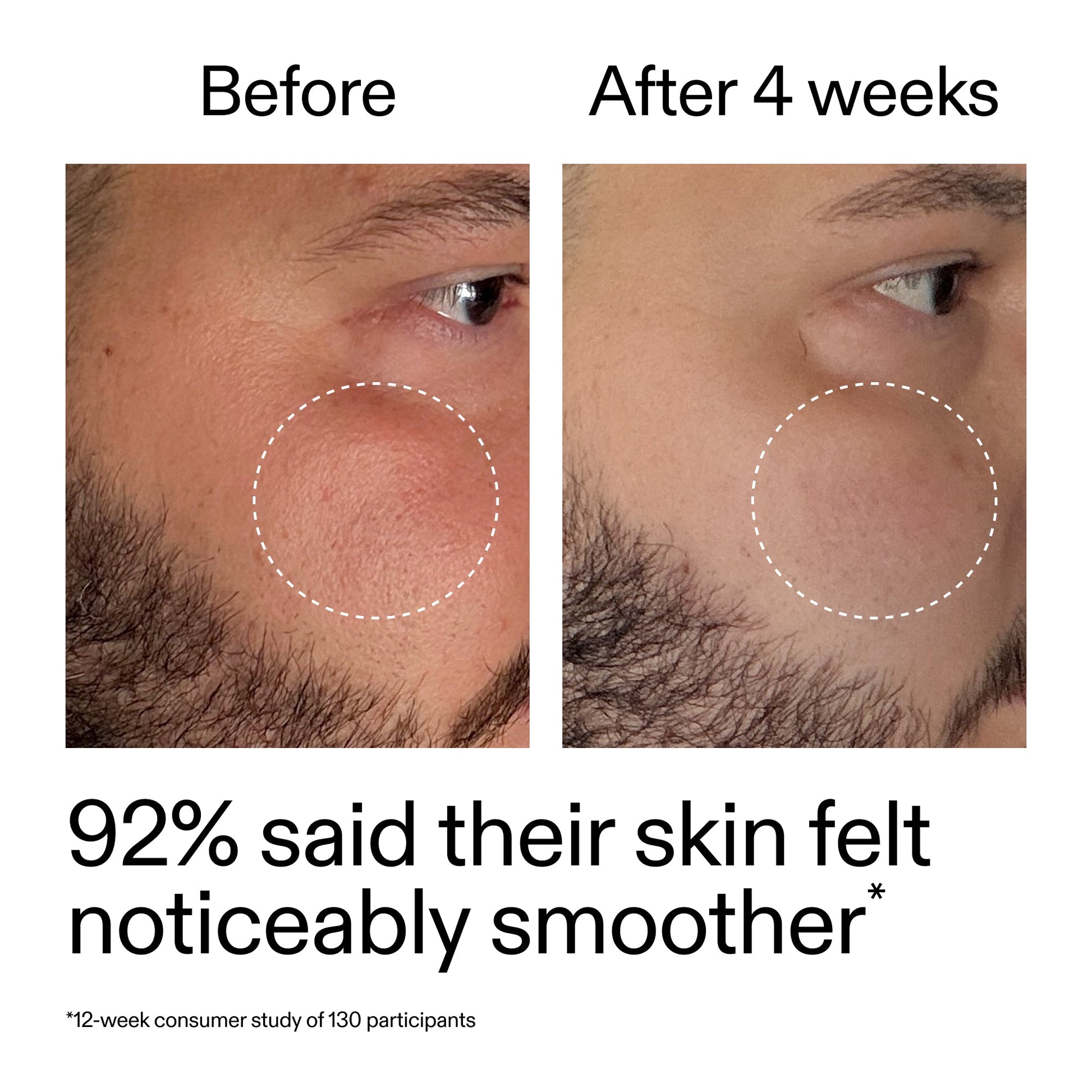 starter-retinol-serum-p7 StarterRetinol_BeforeAfter_Claim3_2000x2000_6ceab106-e0ee-4ed4-ba62-41bc39538038.jpg
