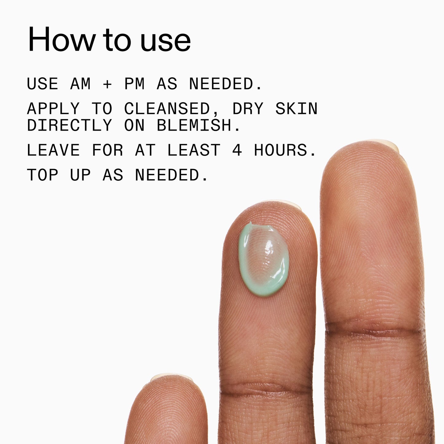 succinic-acid-acne-treatment-t6 Succinic_Acid_Treatment_How_to_Use_2000x2000_d57137d5-d7f1-427c-9a46-5fc00c19c542.jpg