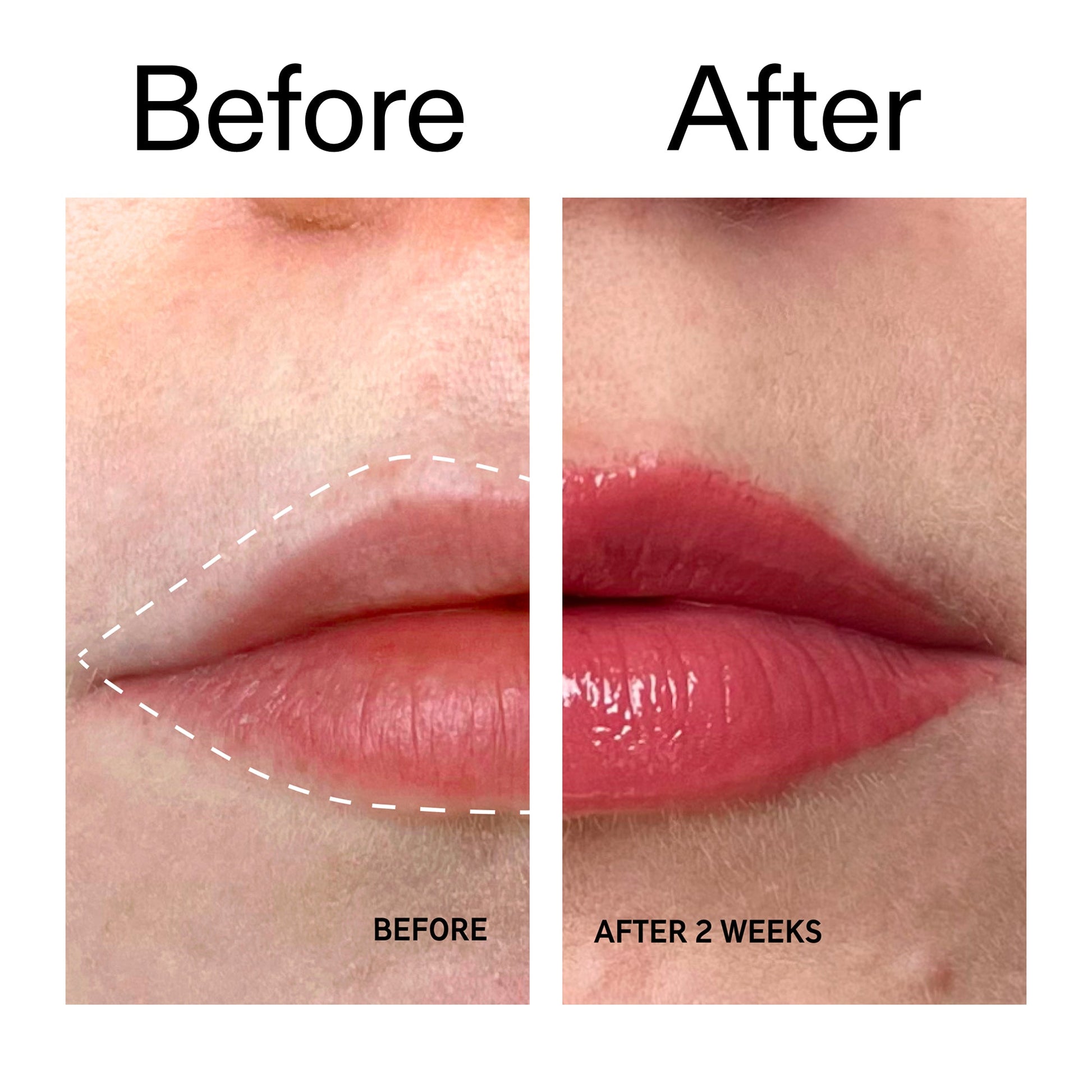 tripeptide-plumping-berry-lip-balm-i9 Tripeptide_Plumping_Lip_Balm_-_Berry_Before_After_2000x2000_9474bbd8-43ca-4b0e-b0e7-dfab70b91927.jpg