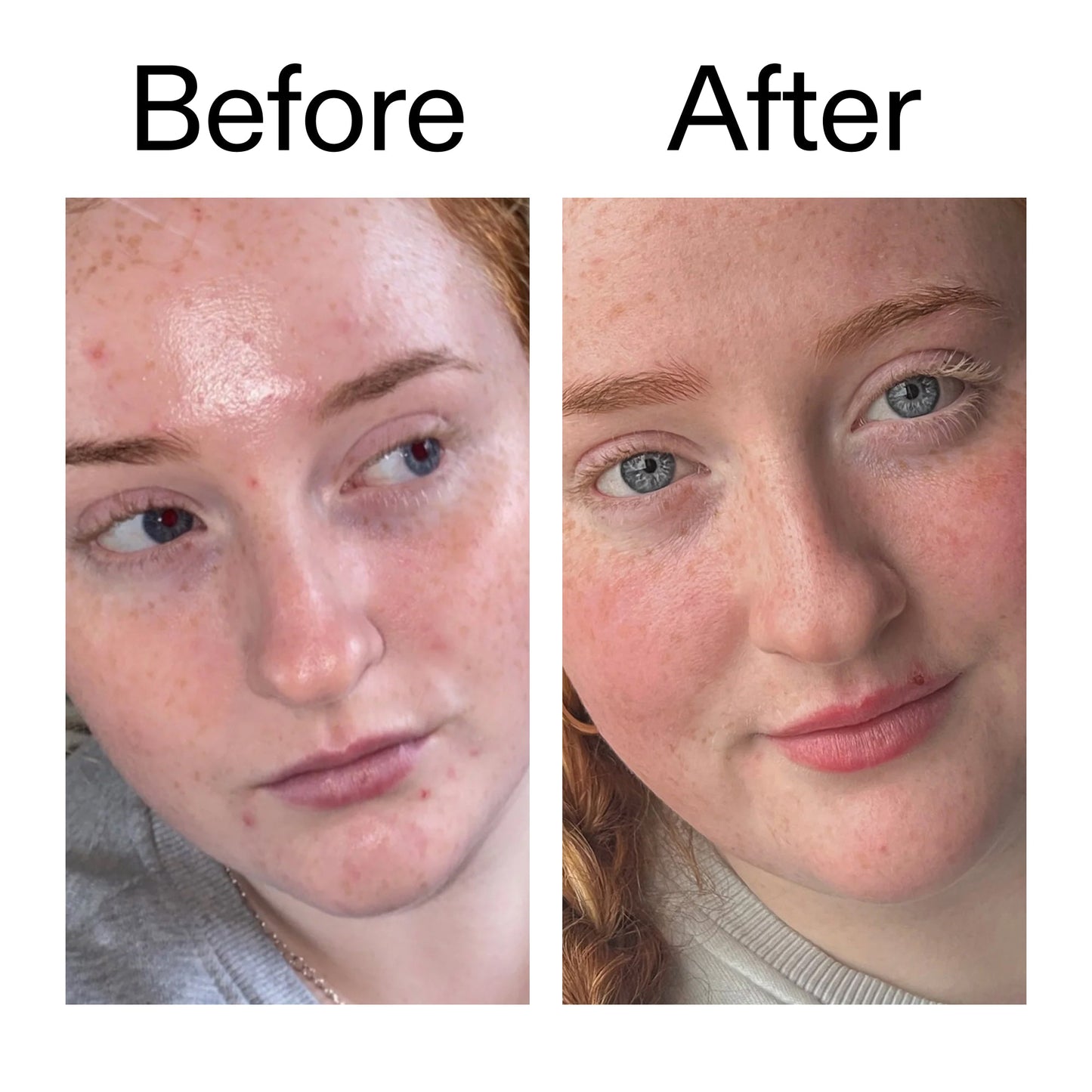 vitamin-b-c-and-e-moisturizer-i3 Vitamin_B_C_and_E_Moisturizer_Before_After_2000x2000_b0781a76-5ad2-4be9-95b8-ef92b356833c.jpg